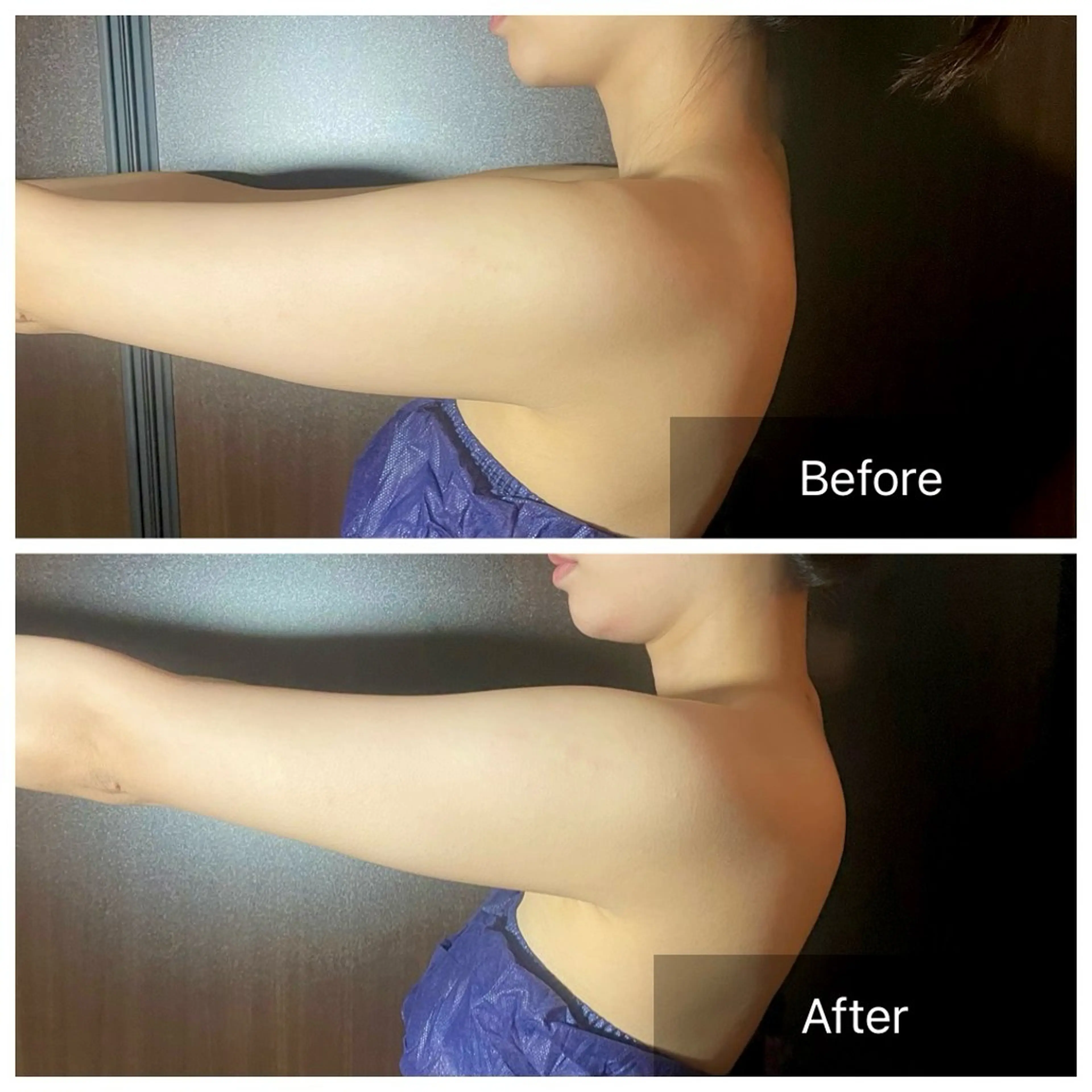 アイブロウ/脱毛/ 肌質改善🌷RINAの眉毛・アイブロウイメージ