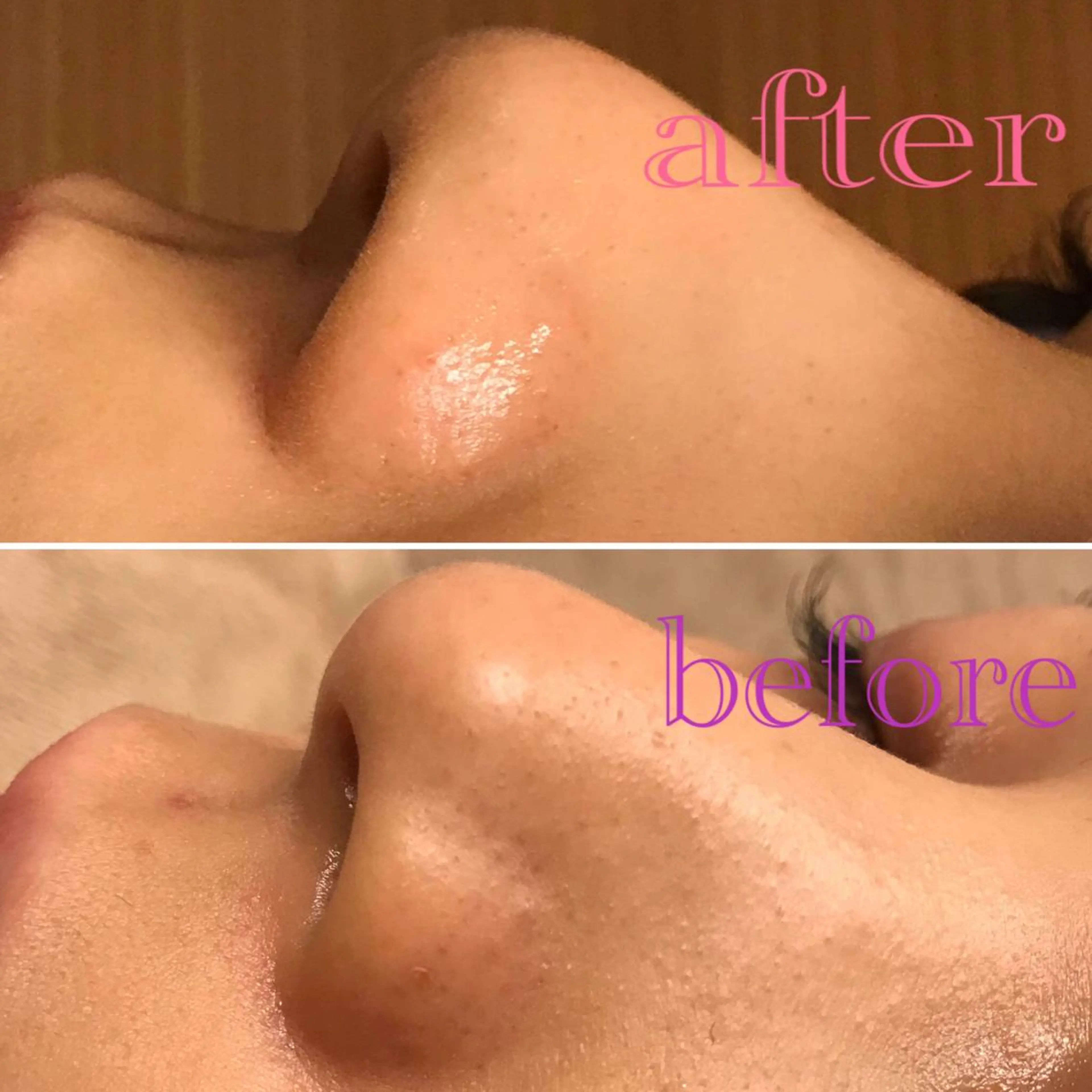 SHINIEST所属・星 めぐみのエステ・リラクイメージ