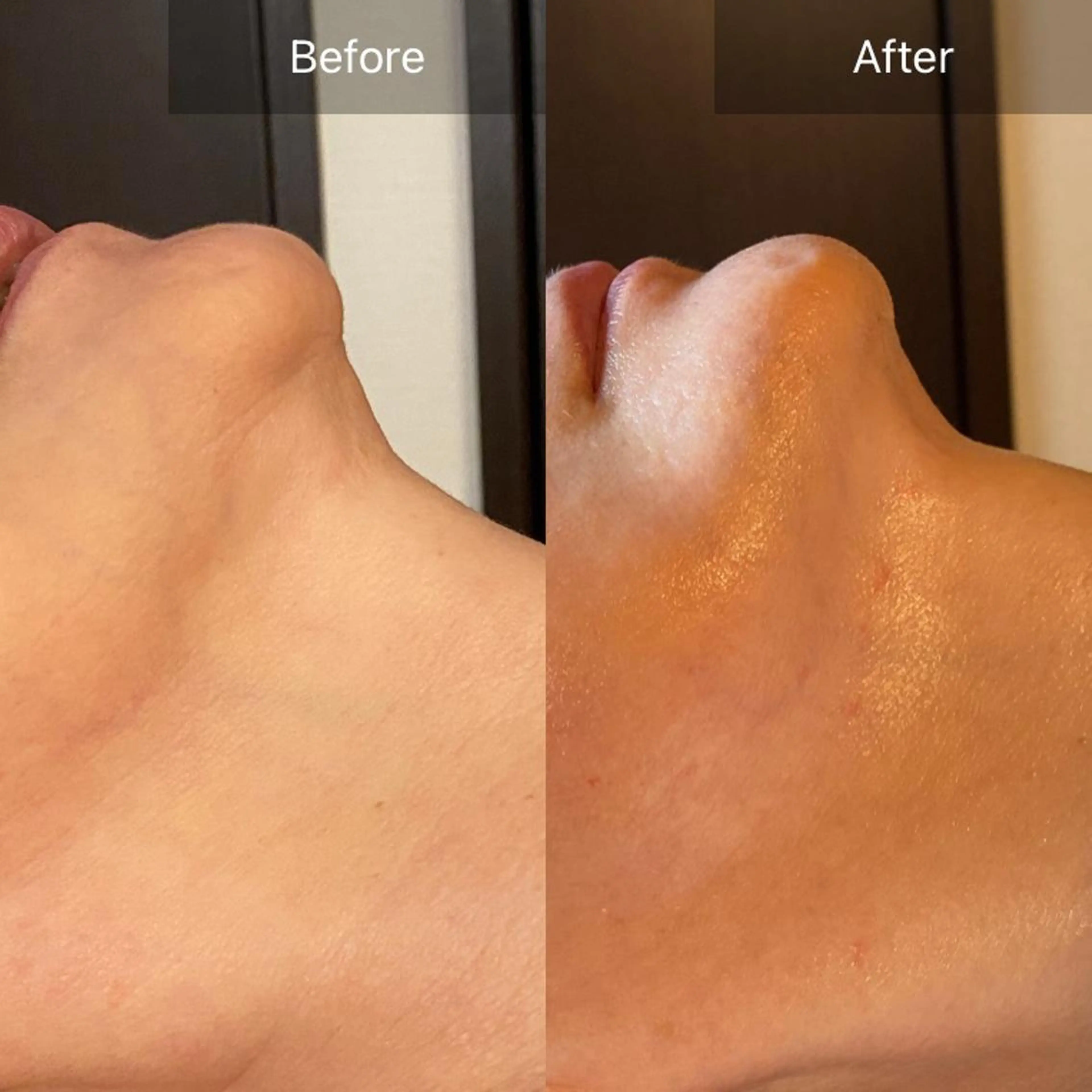 毛穴から始める肌メン テマンダリンオレンジのエステ・リラクイメージ