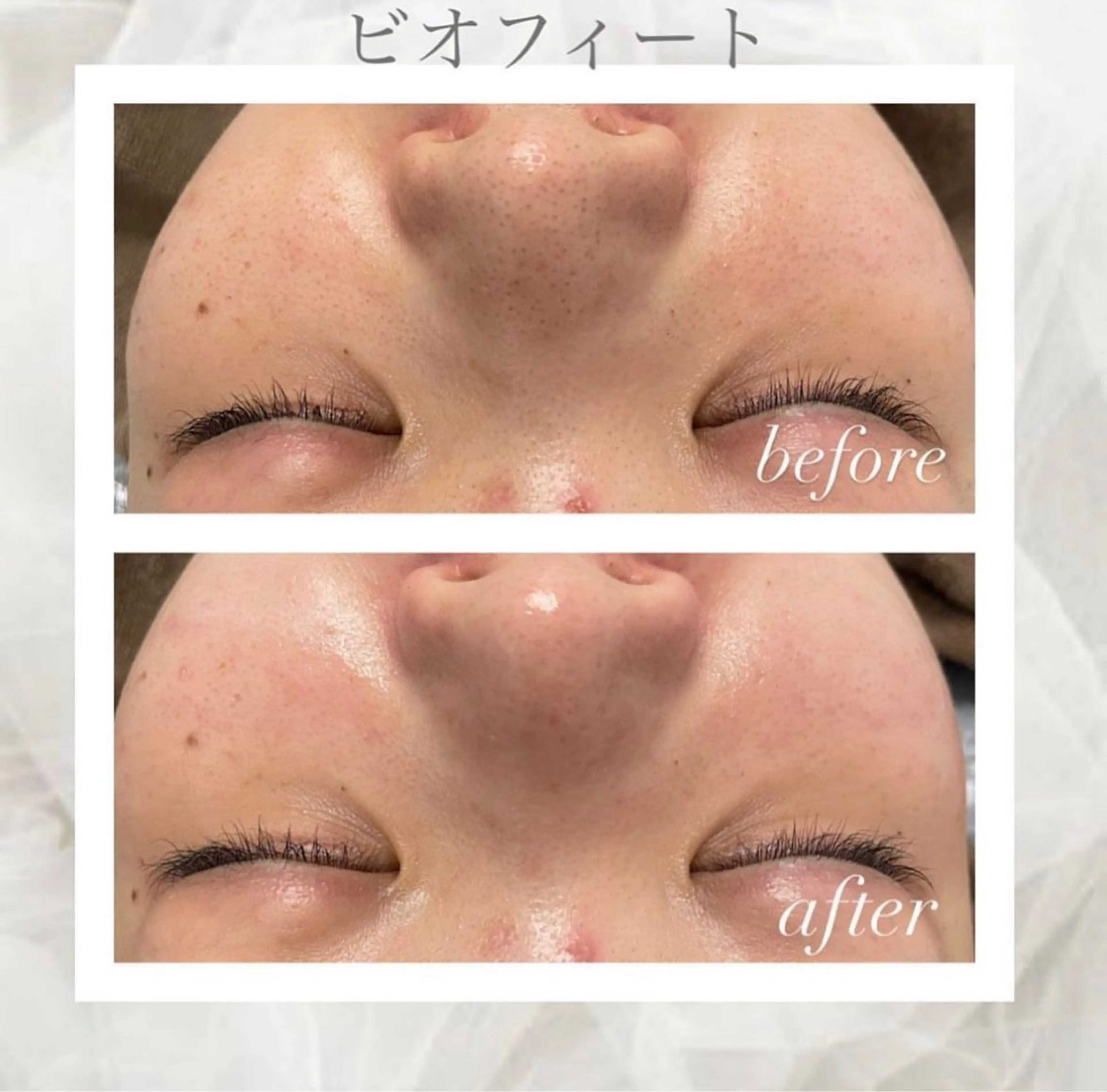 エステ 🦋美肌サロン. maho🦋のエステ・リラクイメージ