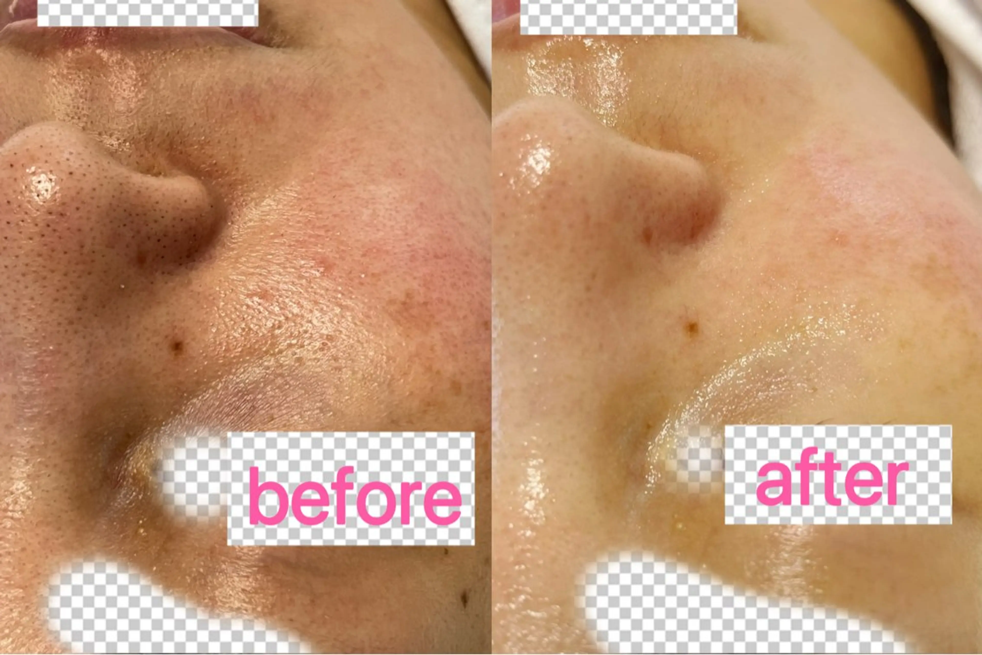 Nature Souce毛穴専門店のその他イメージ