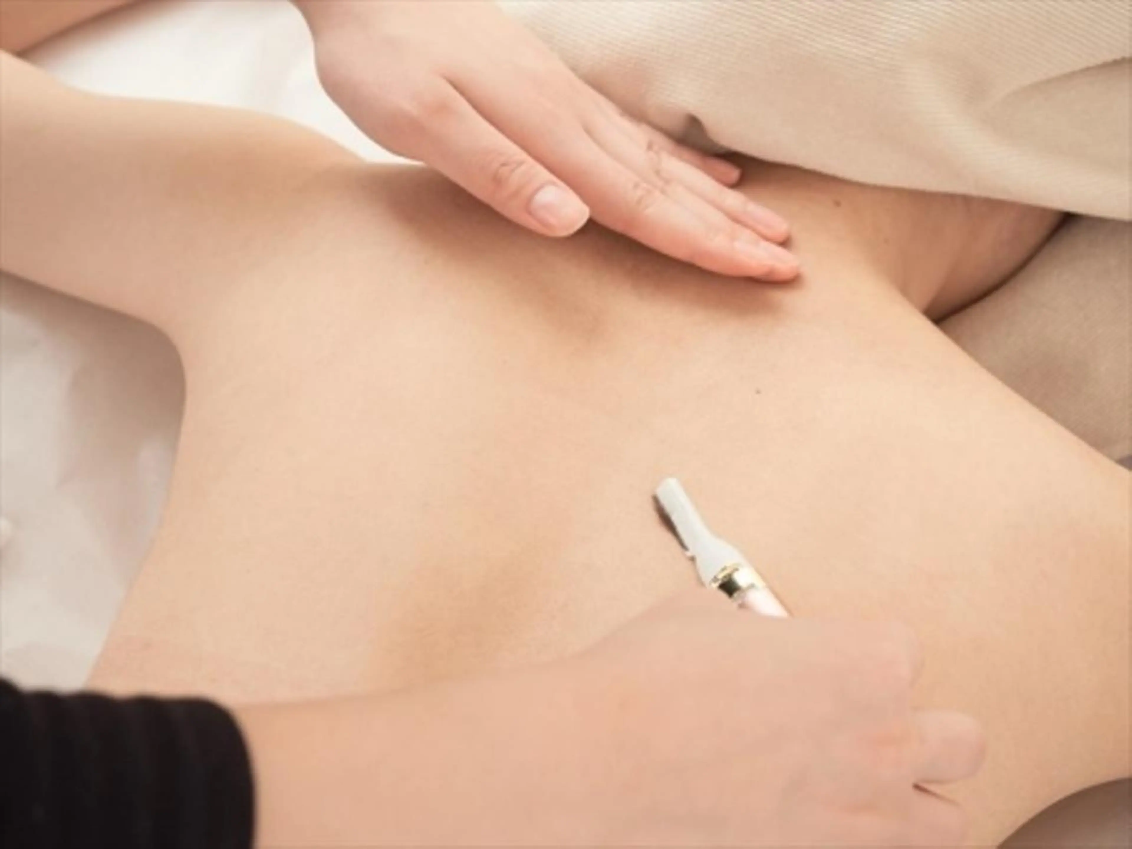 【ご新規様限定】メンテナンスにもオススメ♪手の届かないムダ毛◎ニキビ◎背中光脱毛(シェービング付)1回¥4500の写真