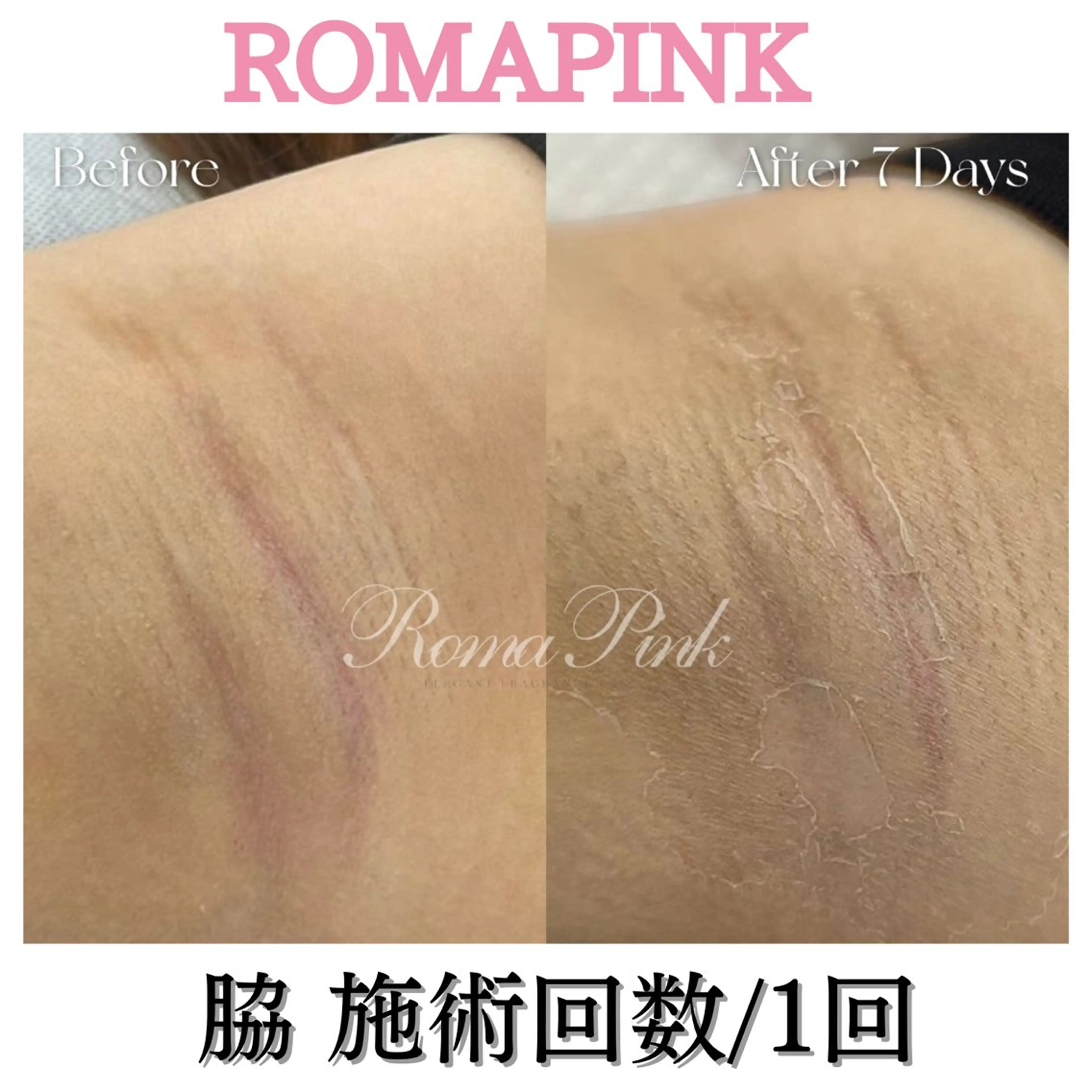 トータルビューティー サロンSalaのマツエク・マツパデザイン