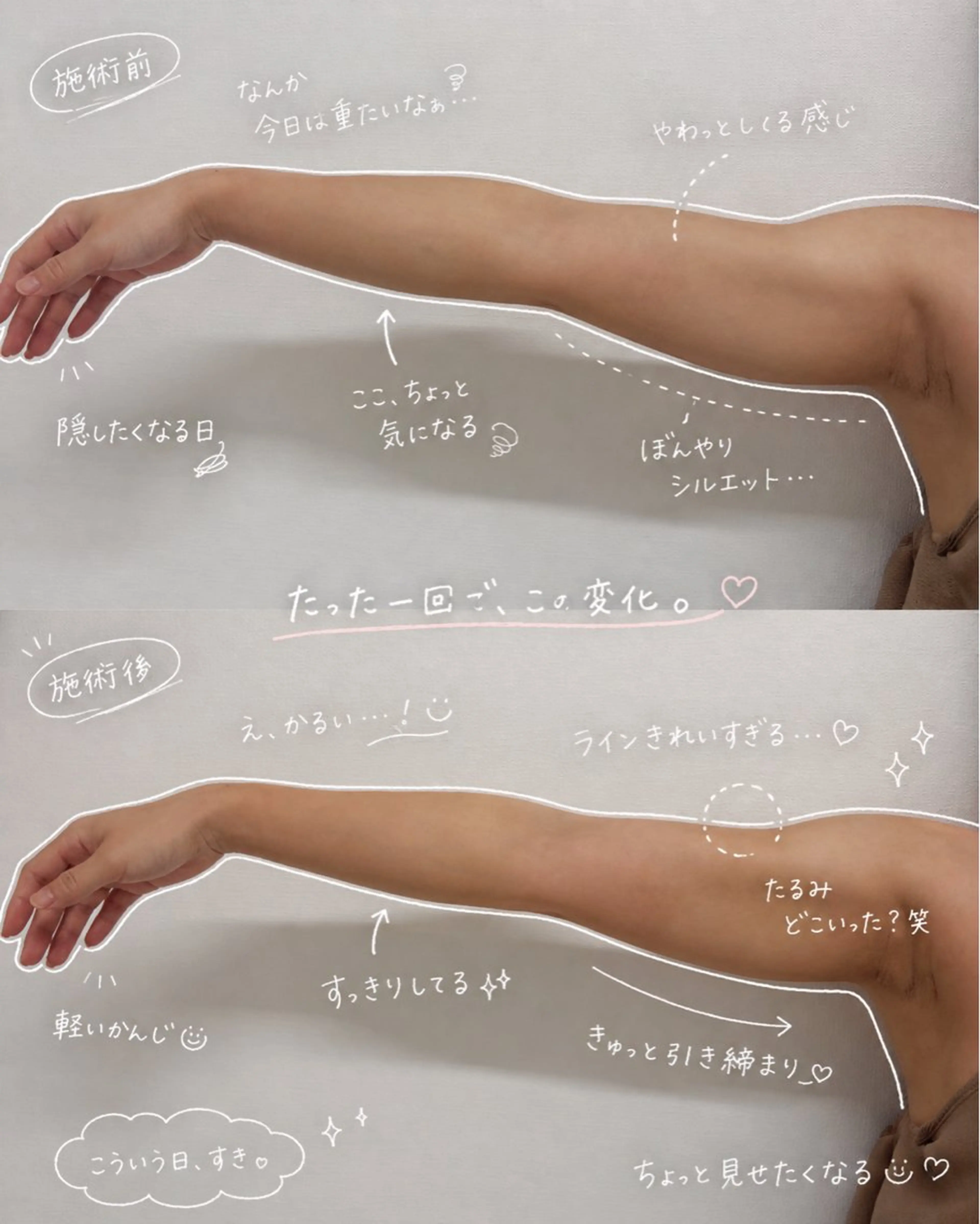 エルモサ痩身脱毛 西八王子店のエステ・リラクイメージ