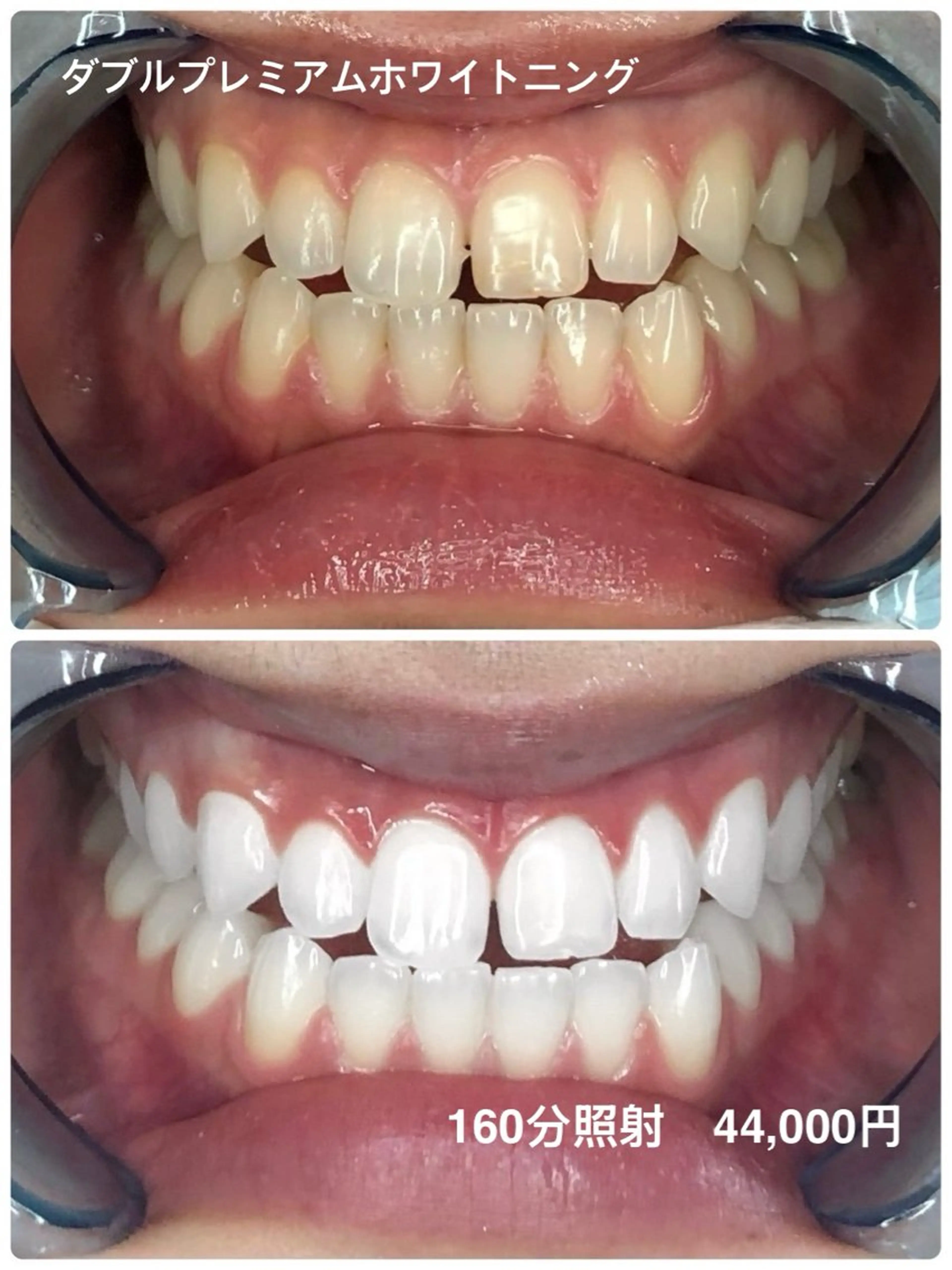 Whitening Beauty 行橋店のその他イメージ