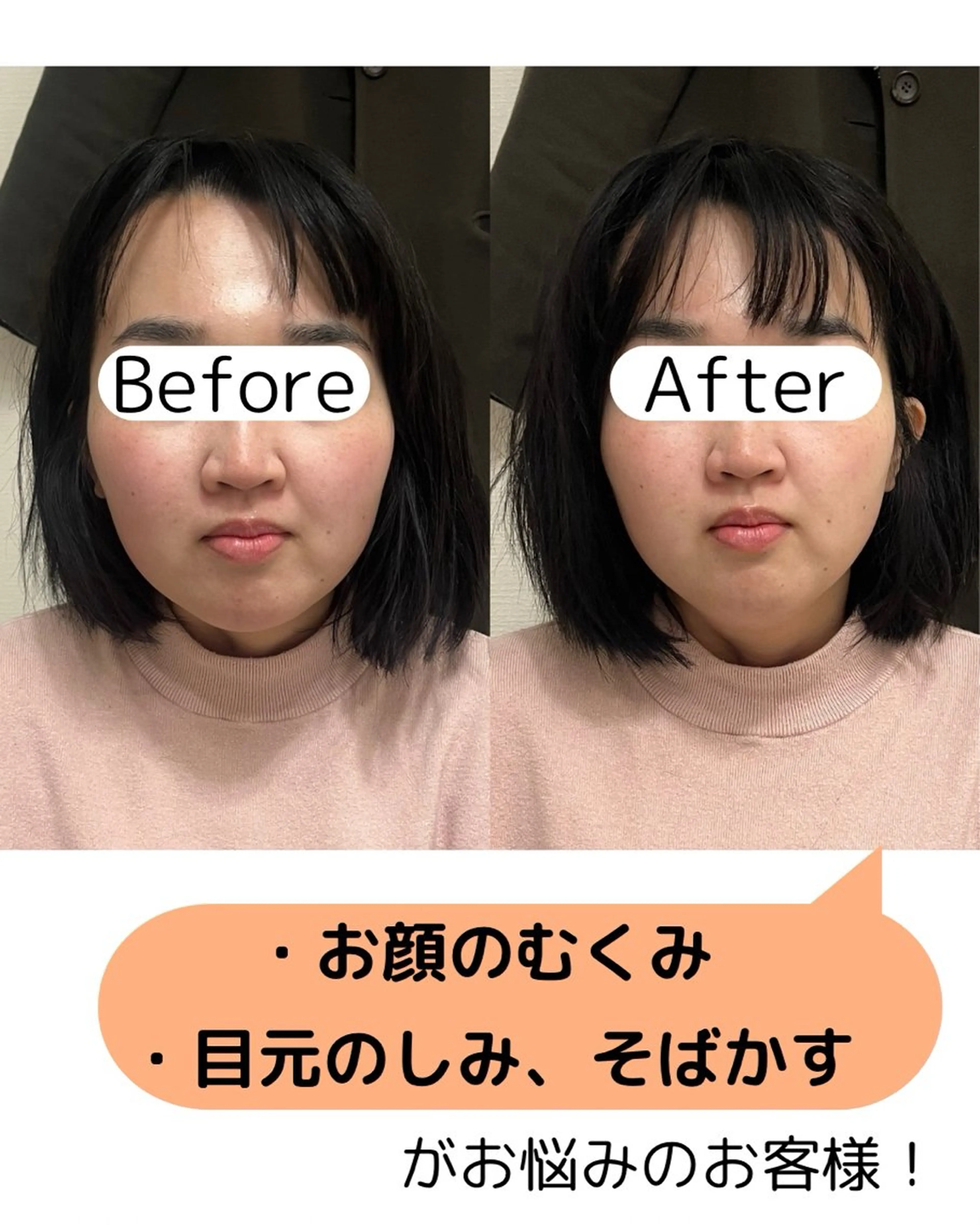 エステ 出張鍼灸師 miyuのエステ・リラクイメージ