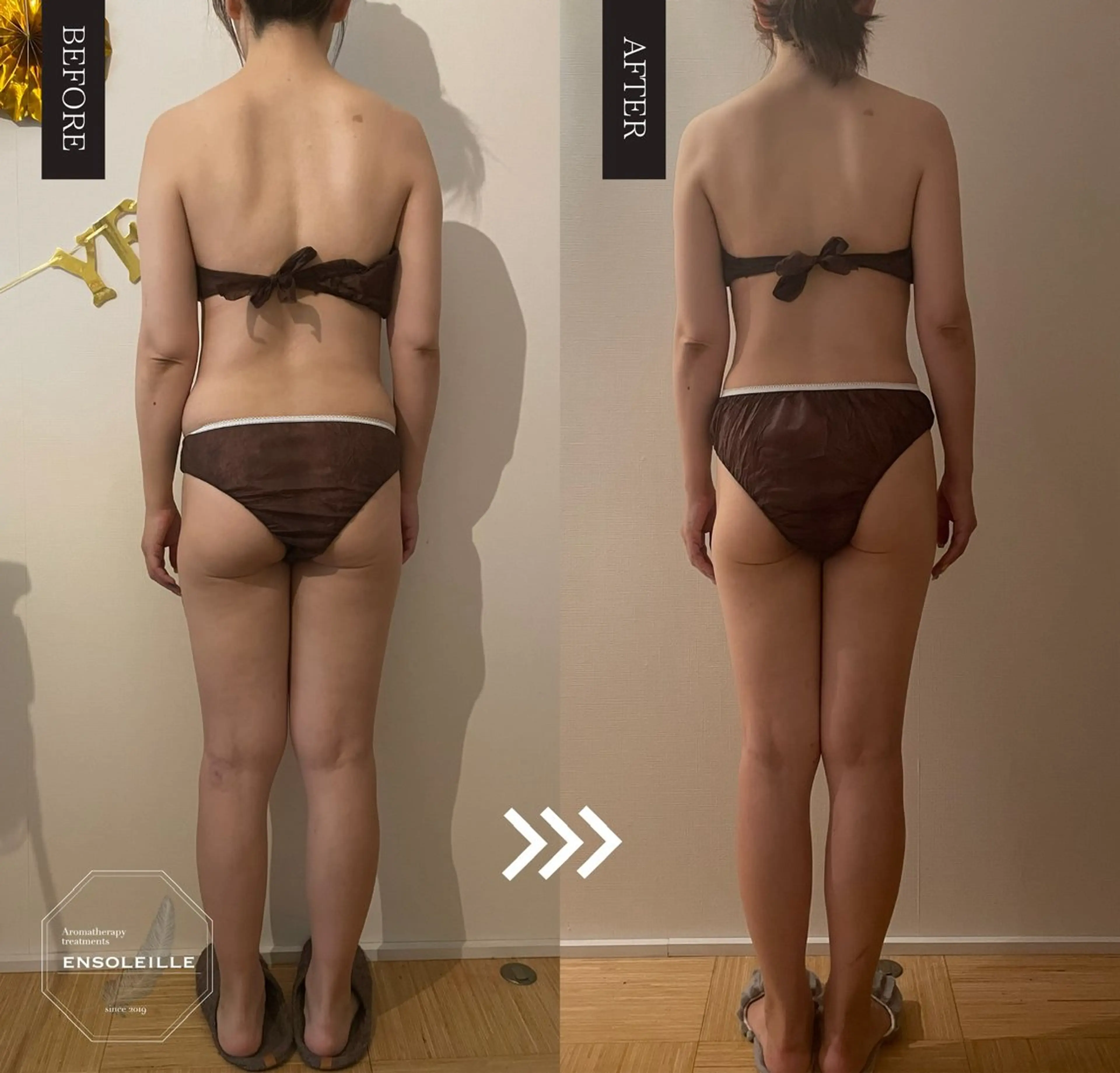 🉐【汗だくデトックス🔥ビフォーアフターで一目瞭然】よもぎ蒸し30分+脂肪温熱痩身マシンセルゼロ90分＜120分＞の写真