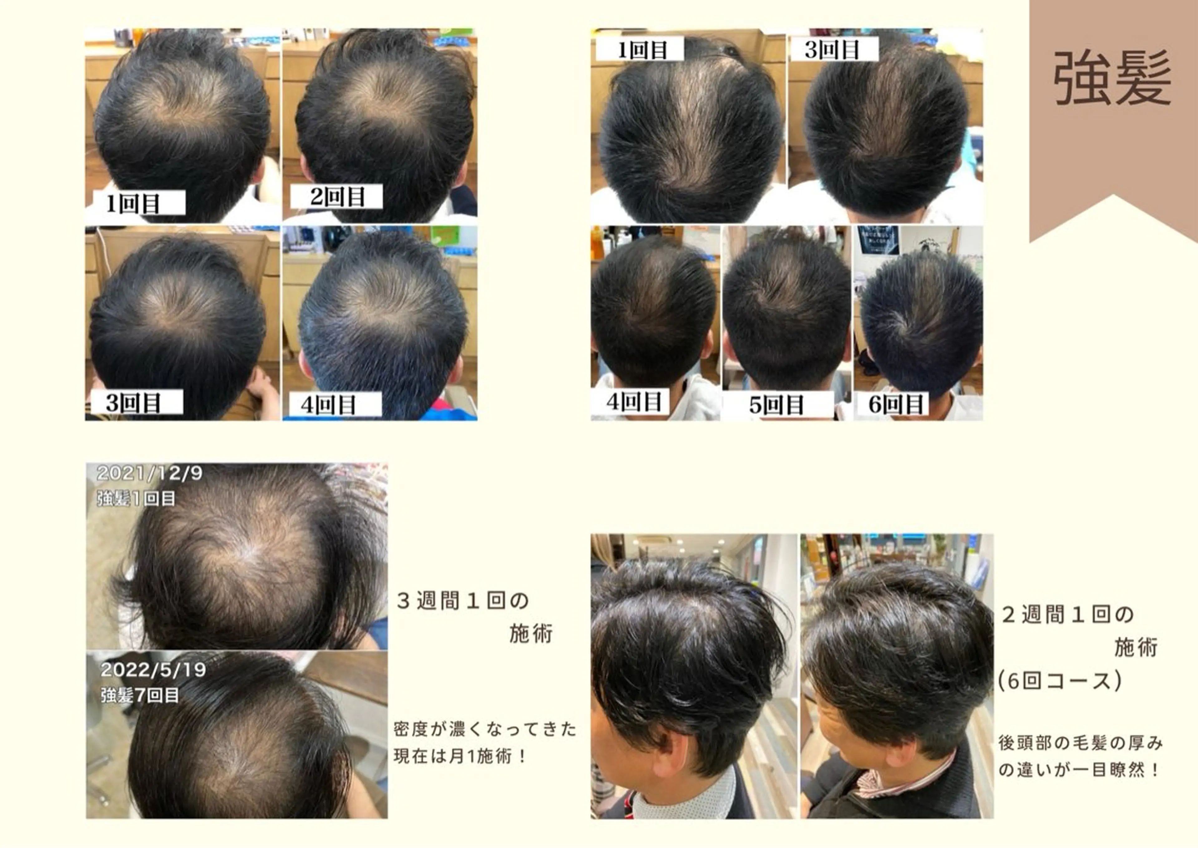 メンズ トリートメント ヘッドスパ 痩身・脱毛・美髪ケア 【GLYCINE】のエステ・リラクイメージ