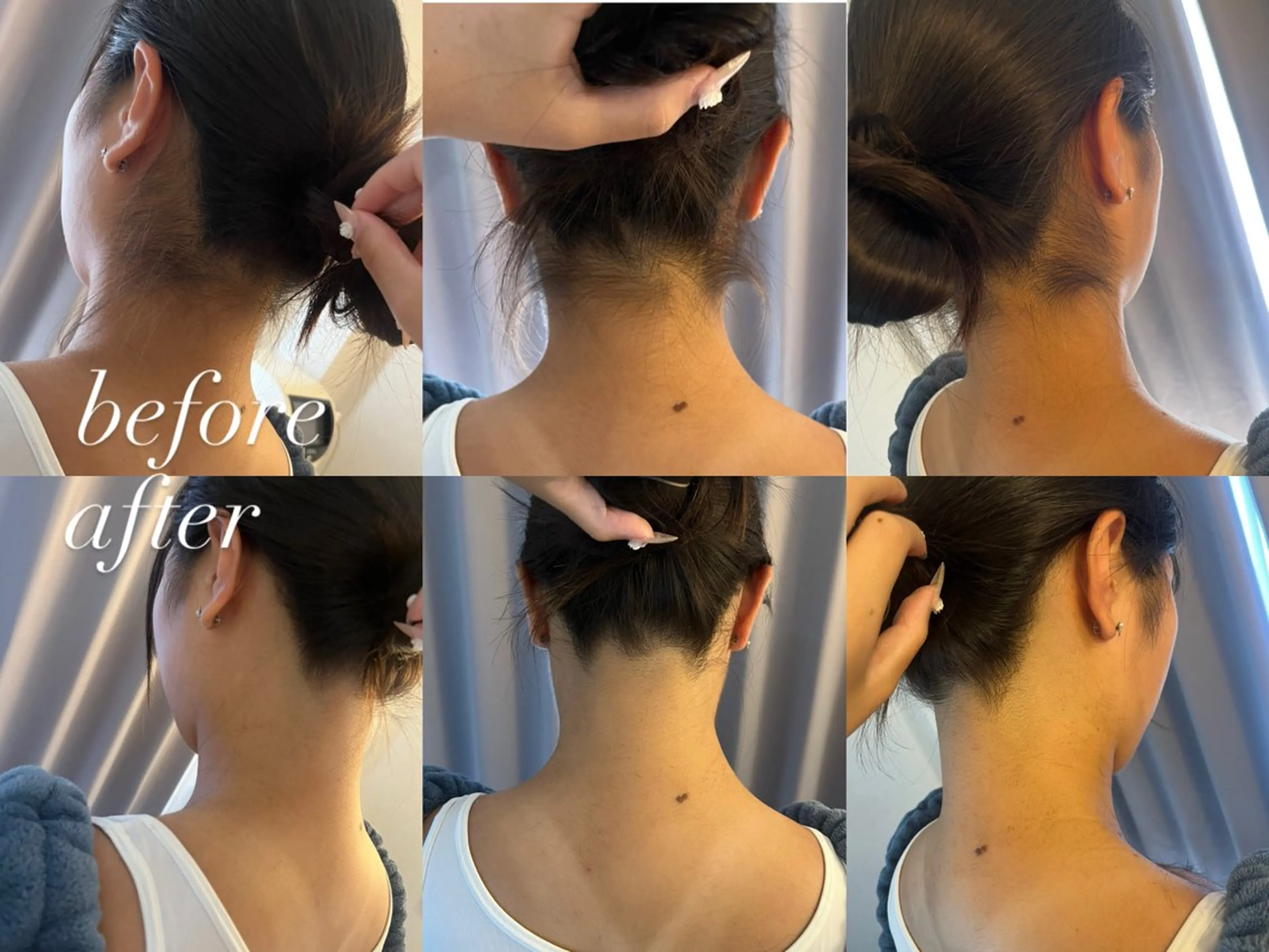 うなじ脱毛/美肌脱毛 LABELのエステ・リラクイメージ