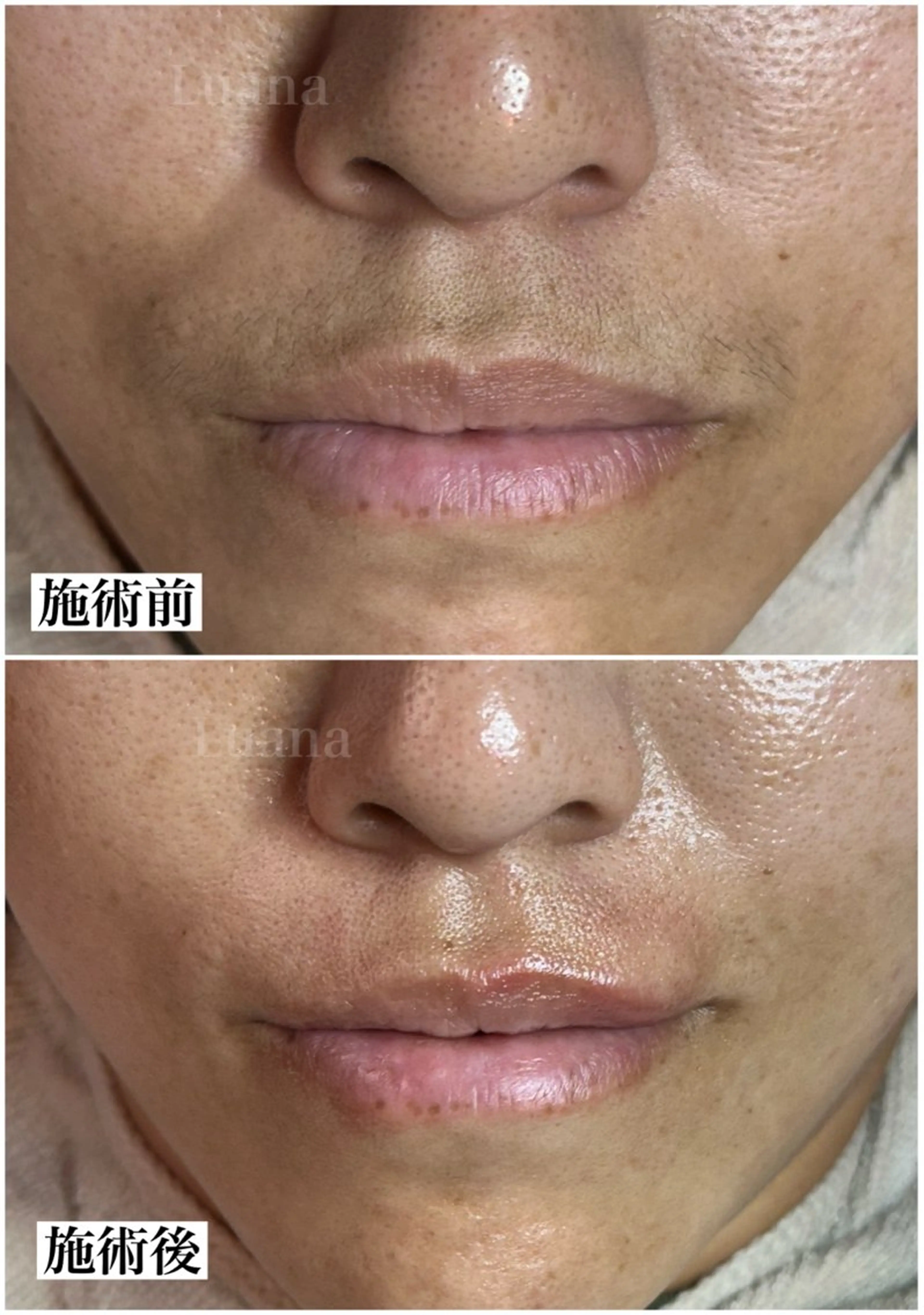 マツヤニWax専門/ 岸和田/Luanaのエステ・リラクイメージ