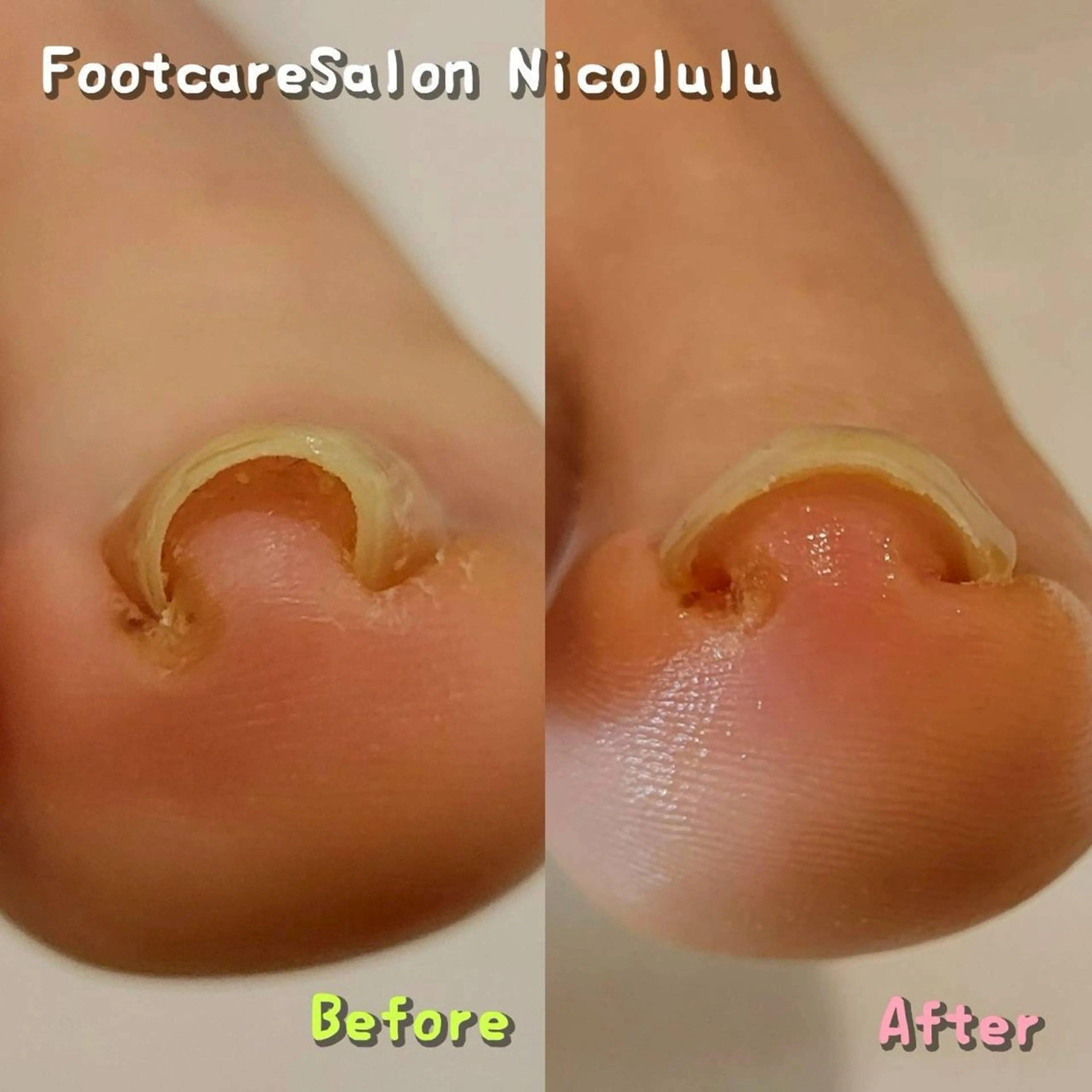 リラク 足トラブル専門 ニコルル金沢のエステ・リラクイメージ