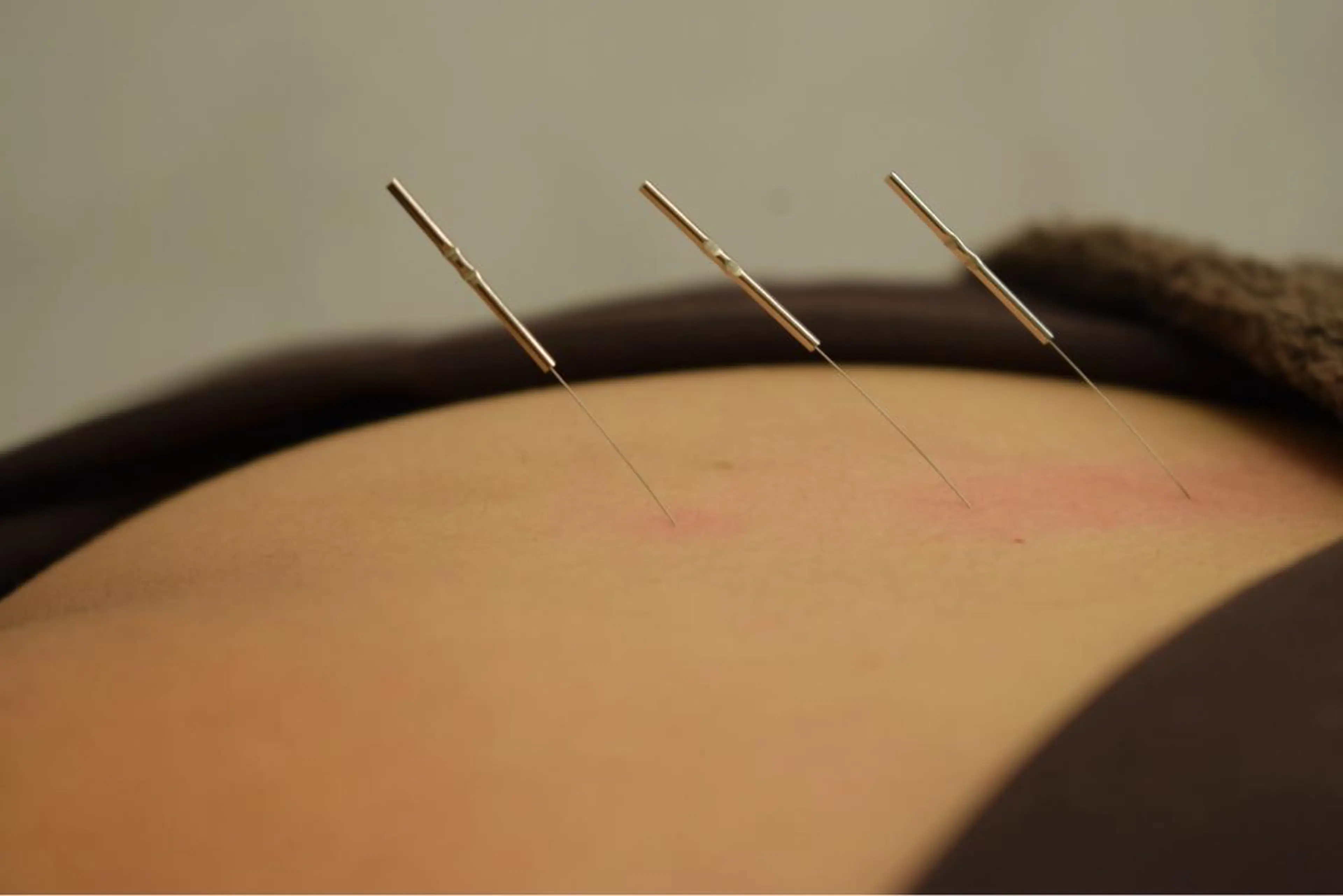 アオイ 【IGO】のエステ・リラクイメージ