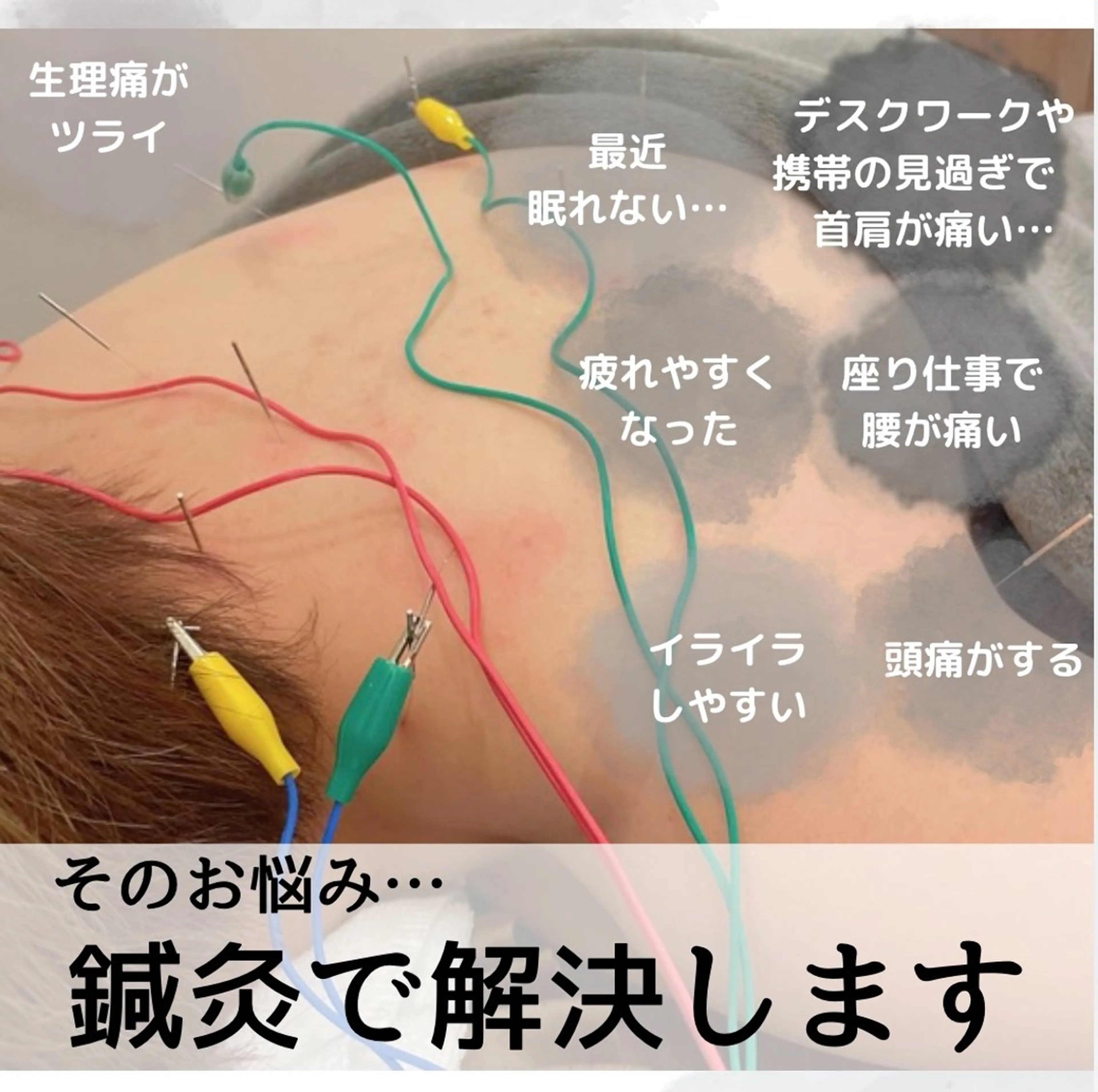 美容鍼/鍼灸 ここみ鍼灸院のエステ・リラクイメージ