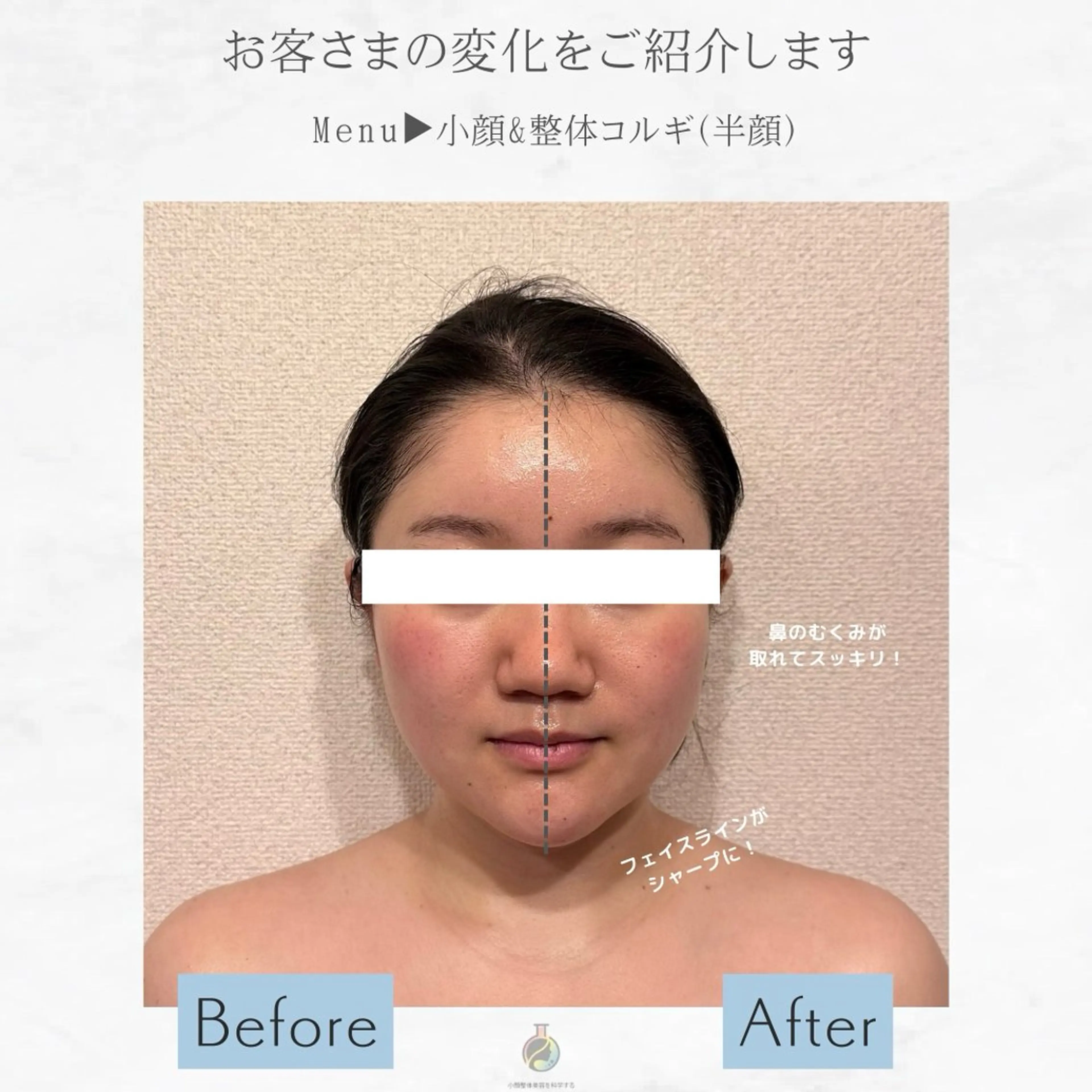 エステ リラク 小顔Face Labo藤沢店所属・小顔フェイスラボ藤沢 山内萌香のエステ・リラクイメージ