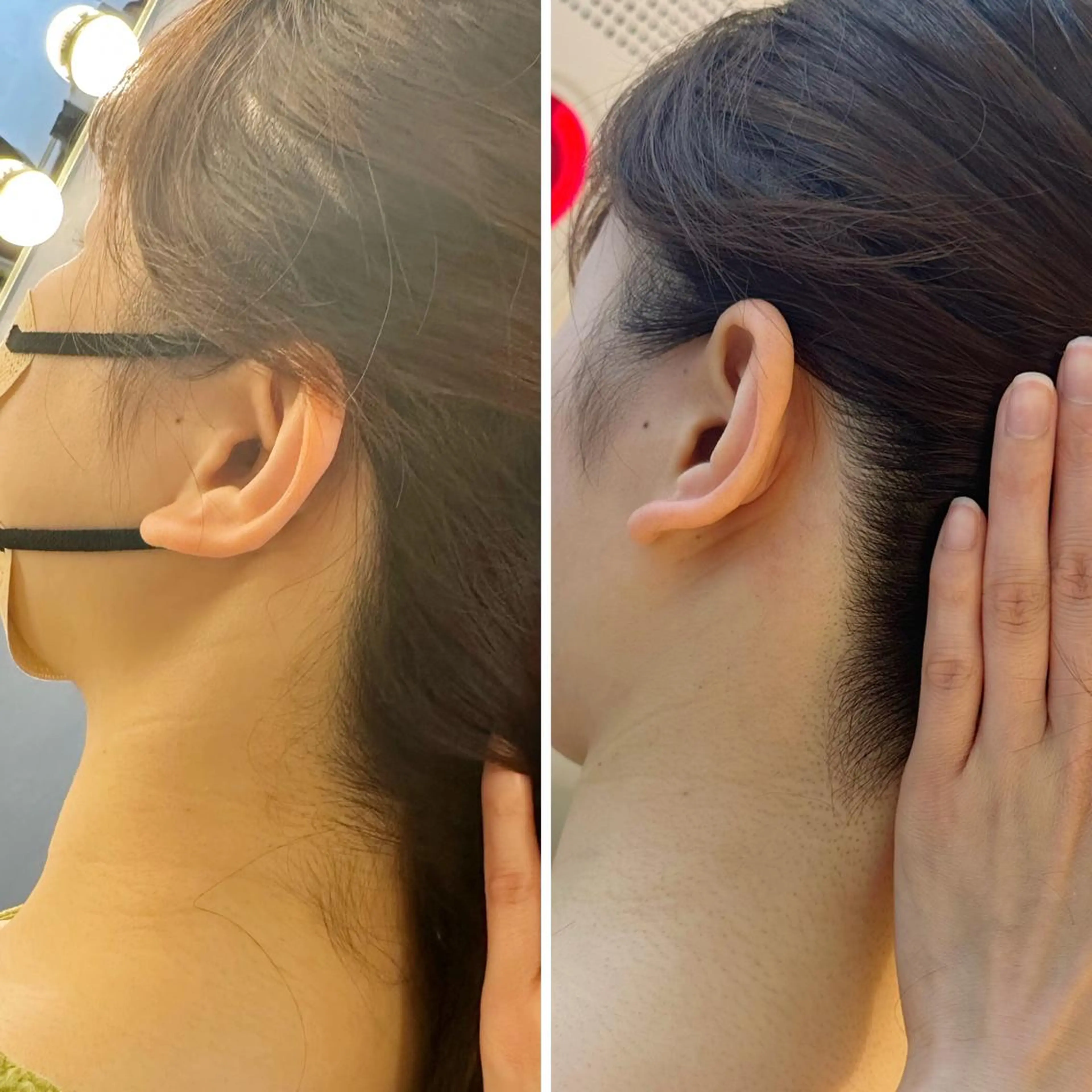 脱毛 うなじ脱毛/美肌脱毛 LABELのエステ・リラクイメージ