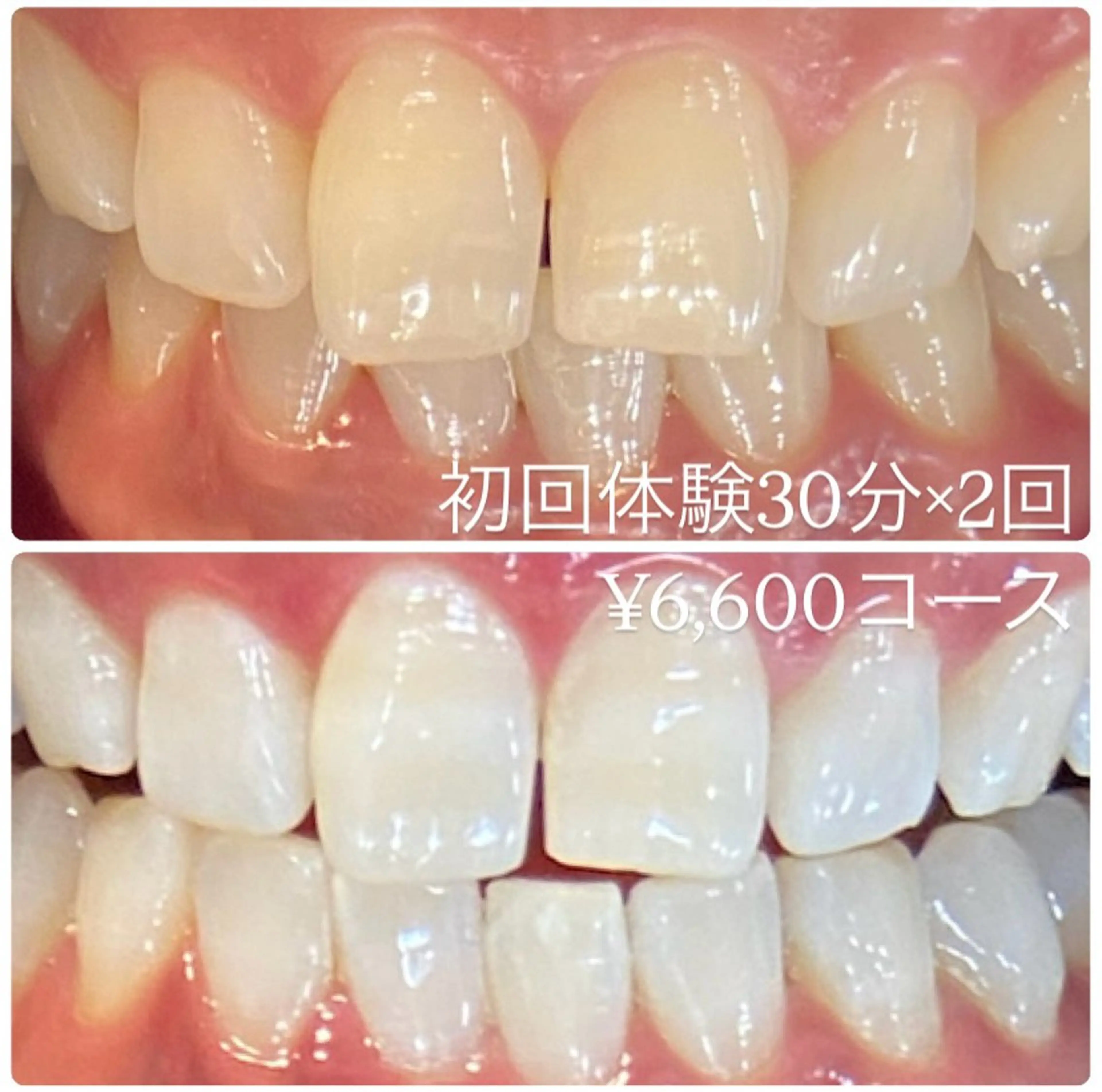 ホワイトニングルーム 横浜店のその他イメージ