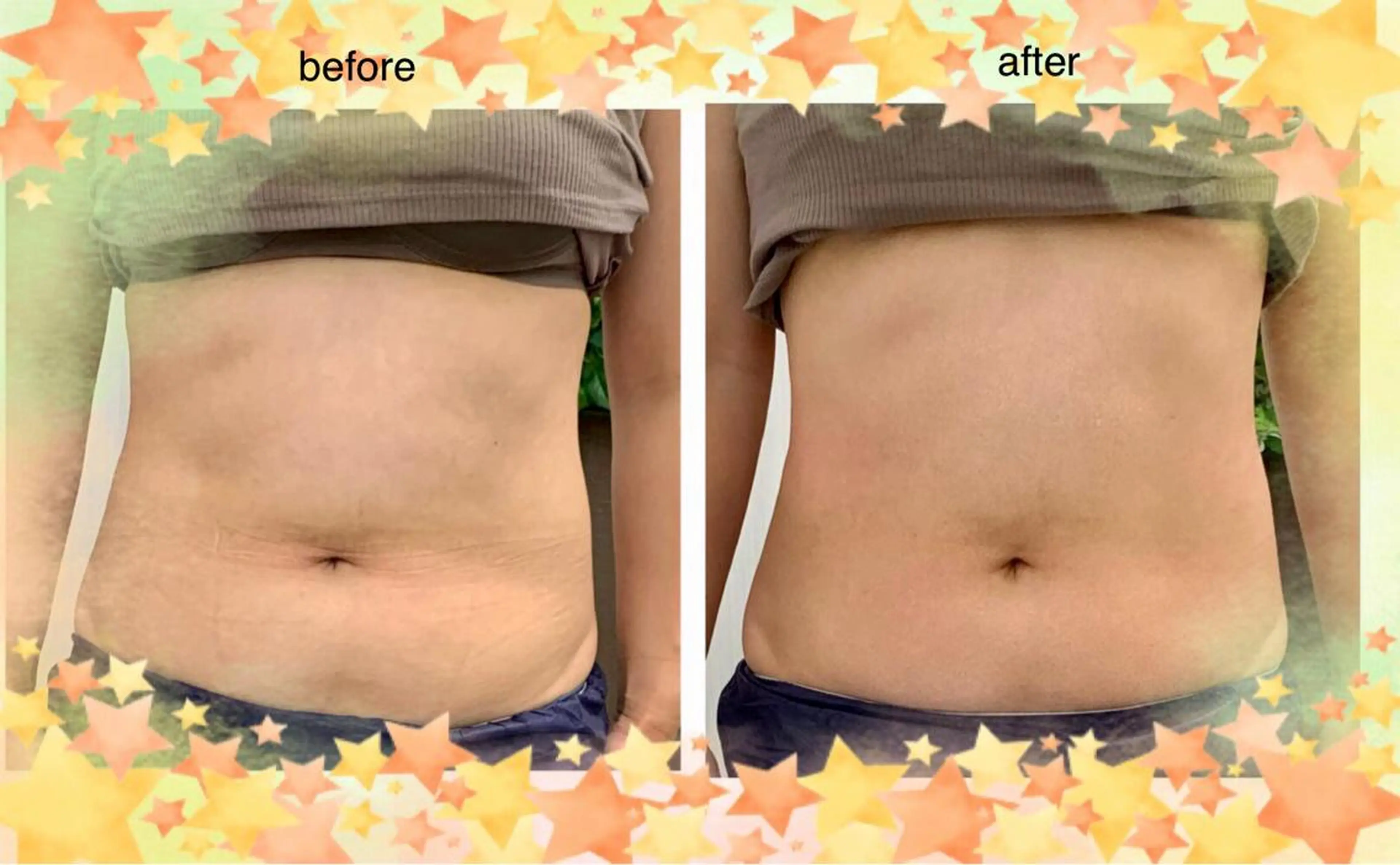 サポート 鍼灸整骨院のエステ・リラクイメージ