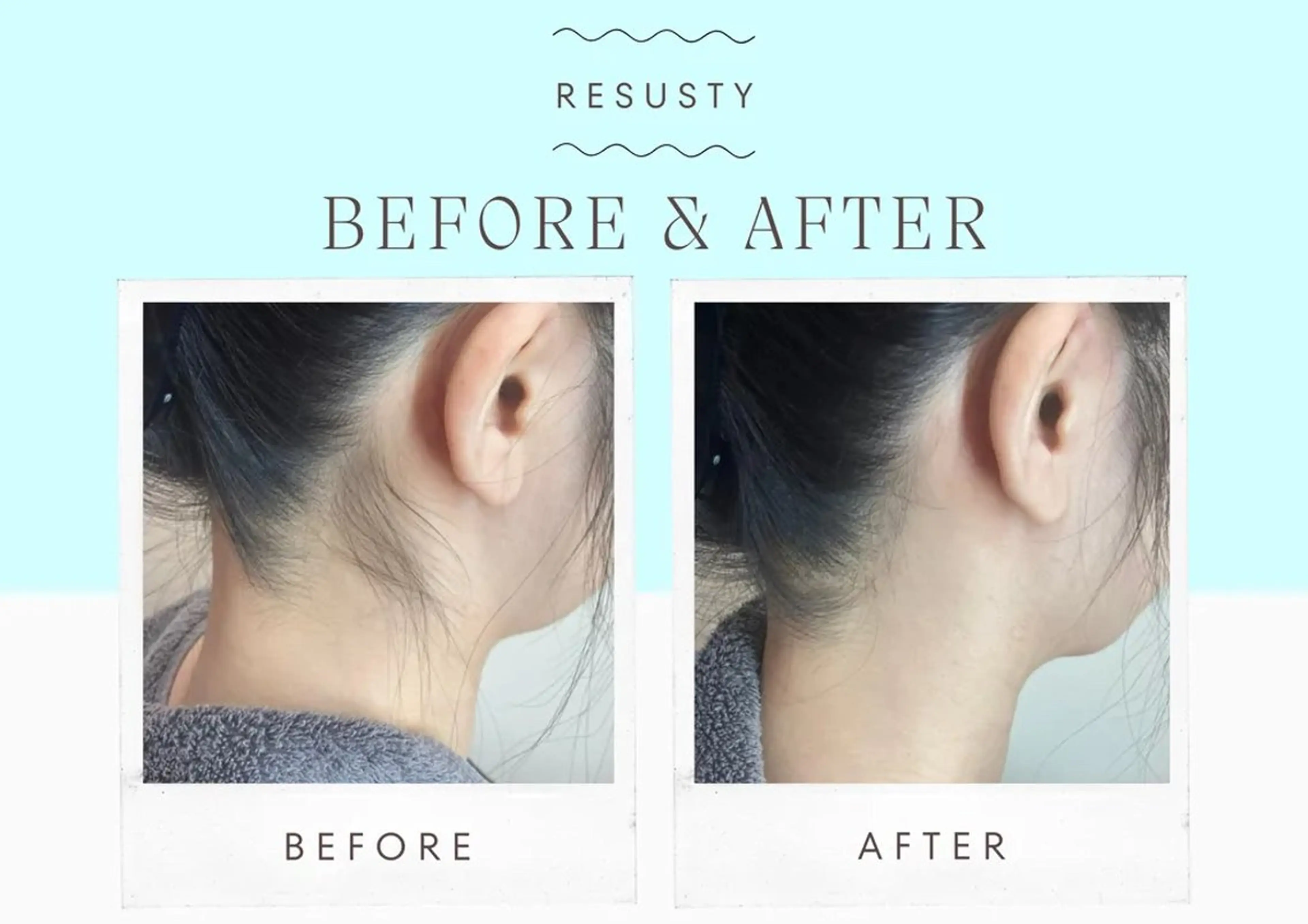 脱毛 MODE K's 白石彩夏のエステ・リラクイメージ