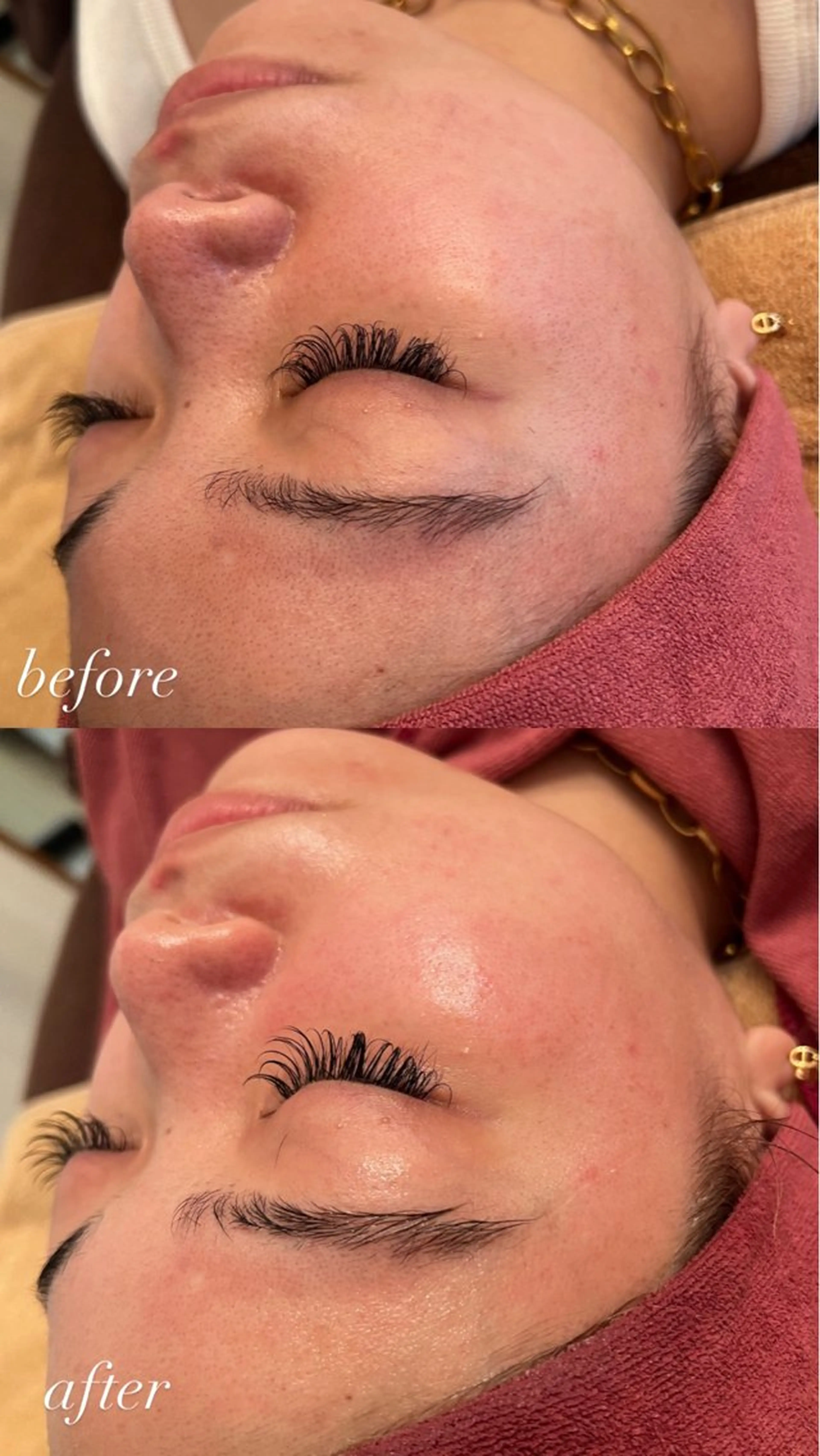 肌管理サロン neoriiのその他イメージ