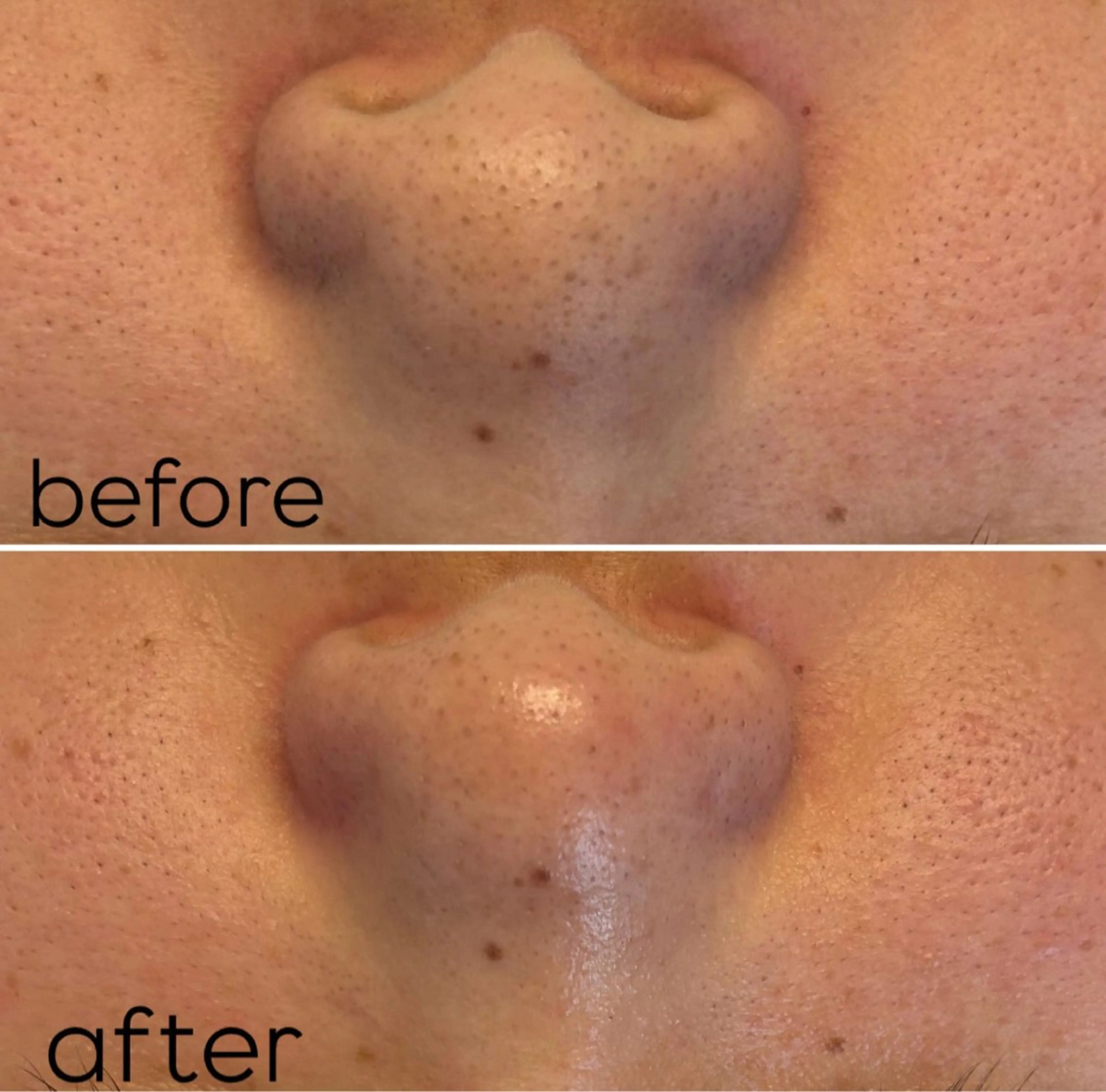 エステ BY  COLOR eyedesinのマツエク・マツパデザイン