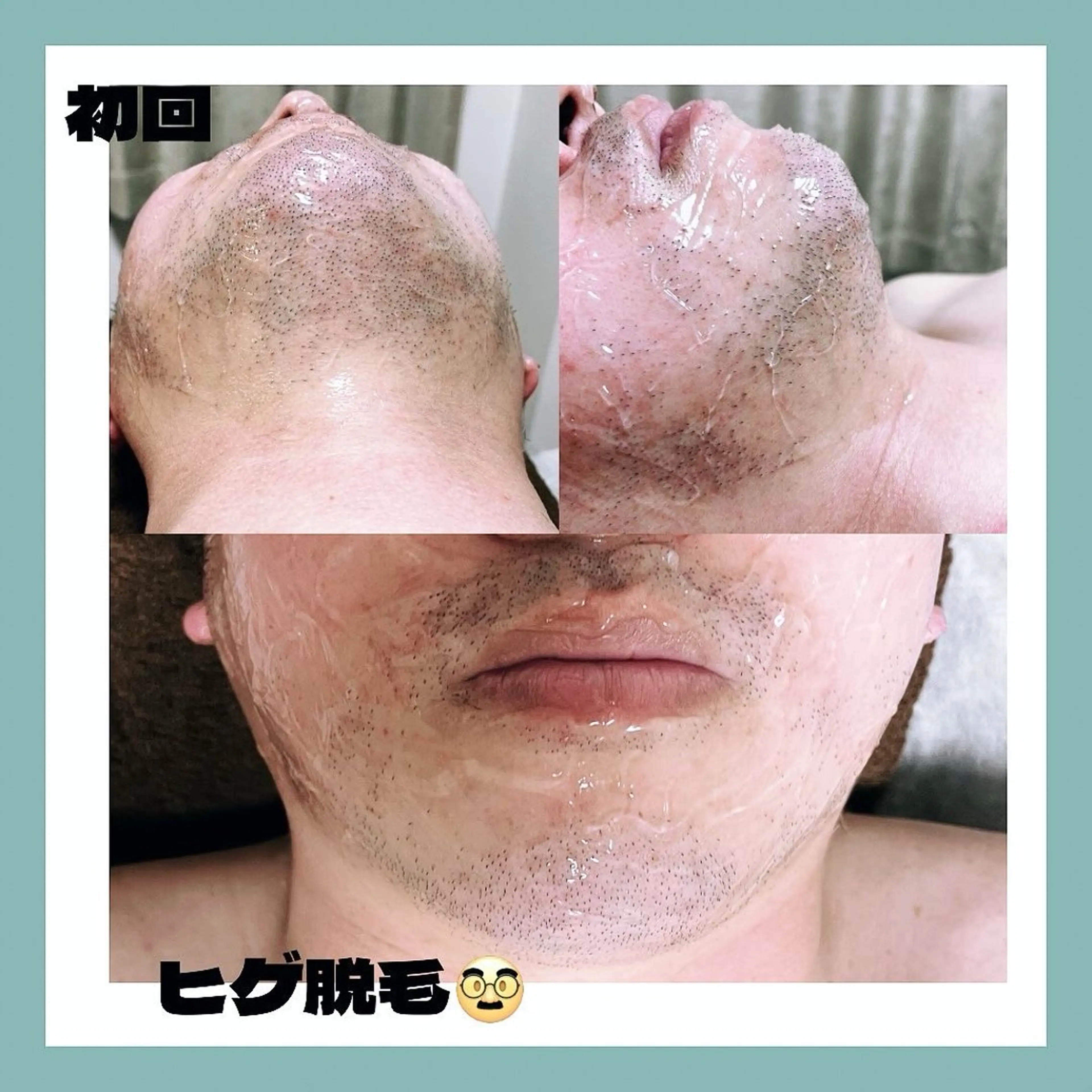 メンズ 脱毛 kaise makiのエステ・リラクイメージ