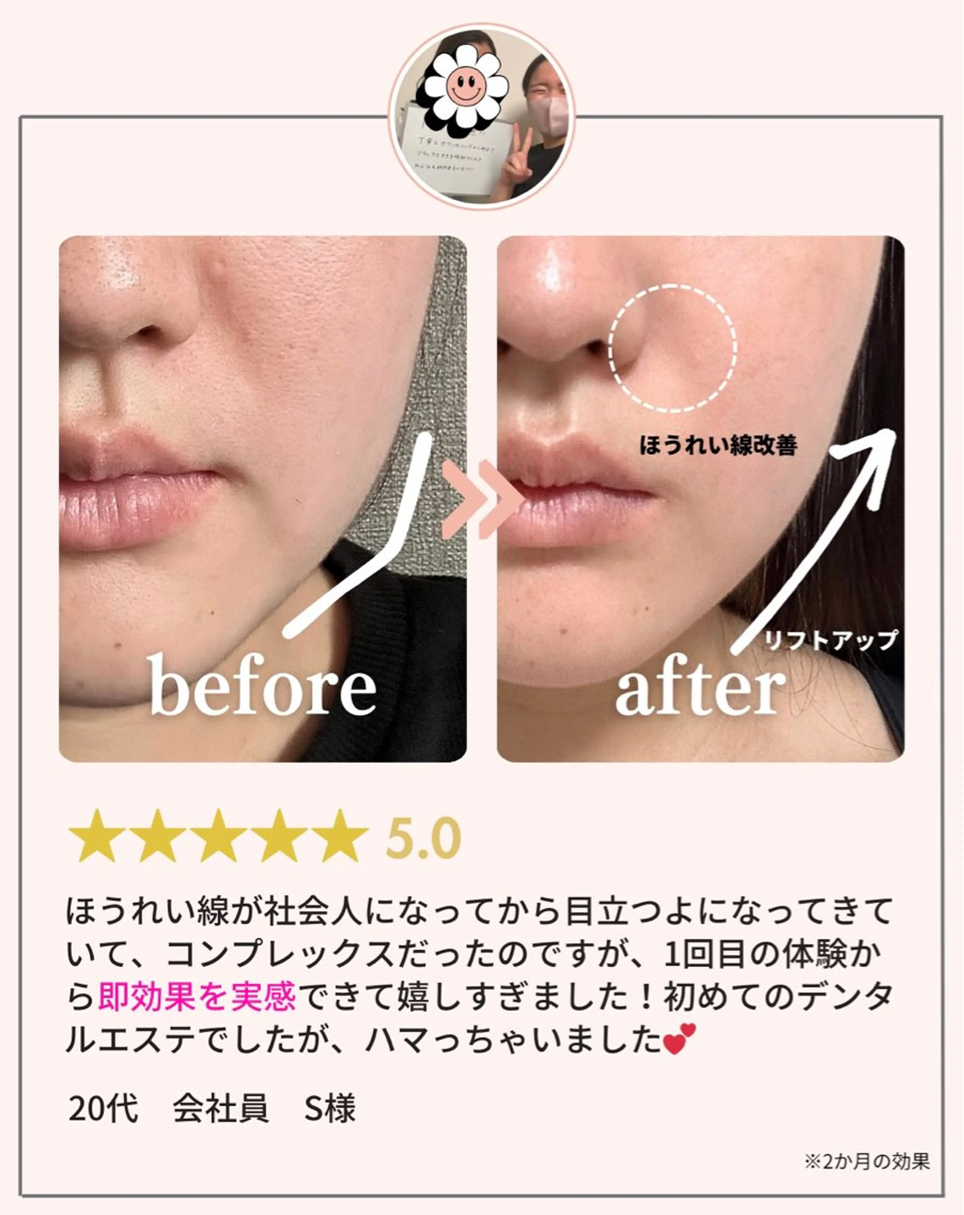 肌質改善・小顔サロン 20代店長RINNAのエステ・リラクイメージ