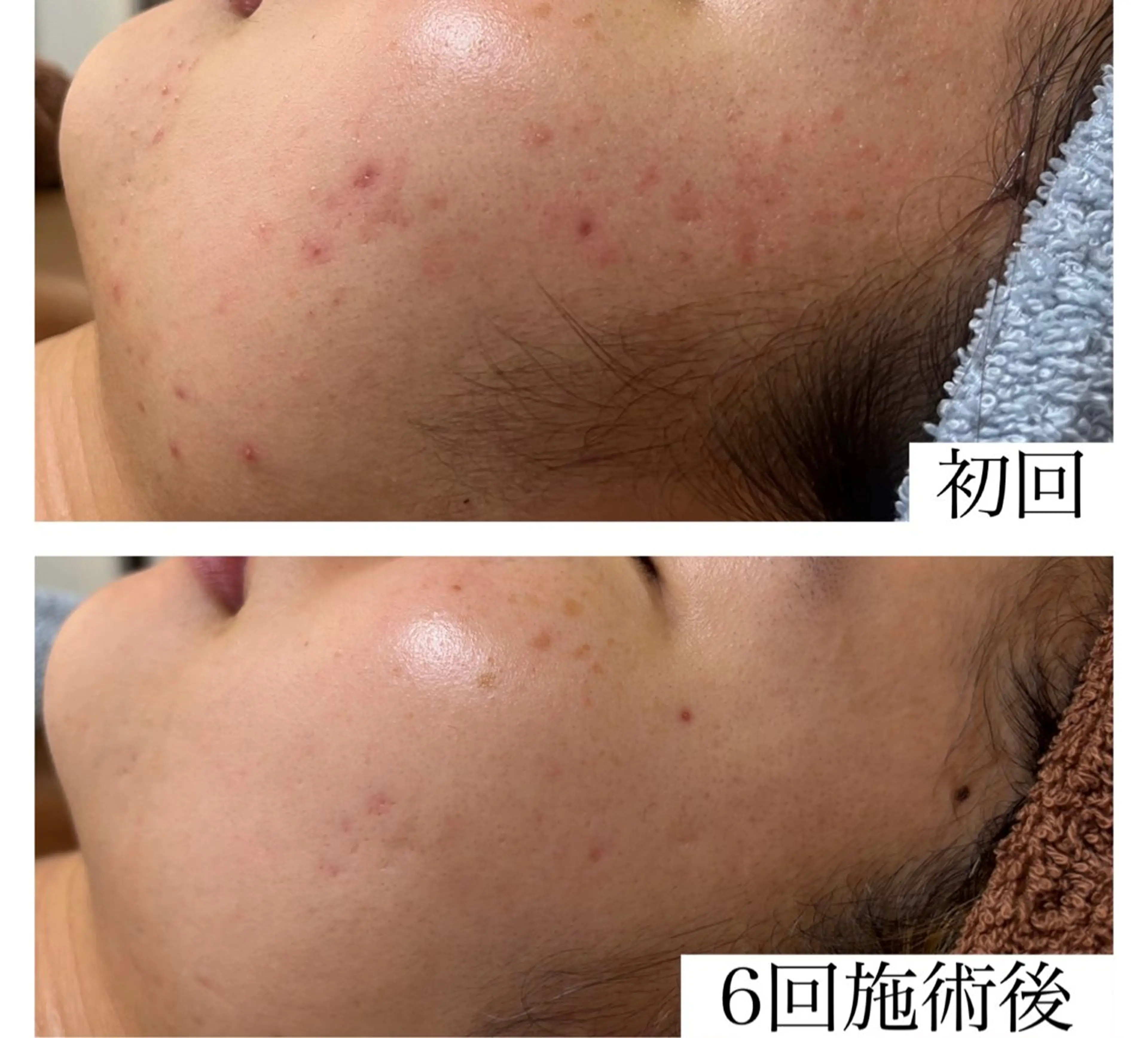 ネイル&エステ phuan(プアン)のネイルデザイン