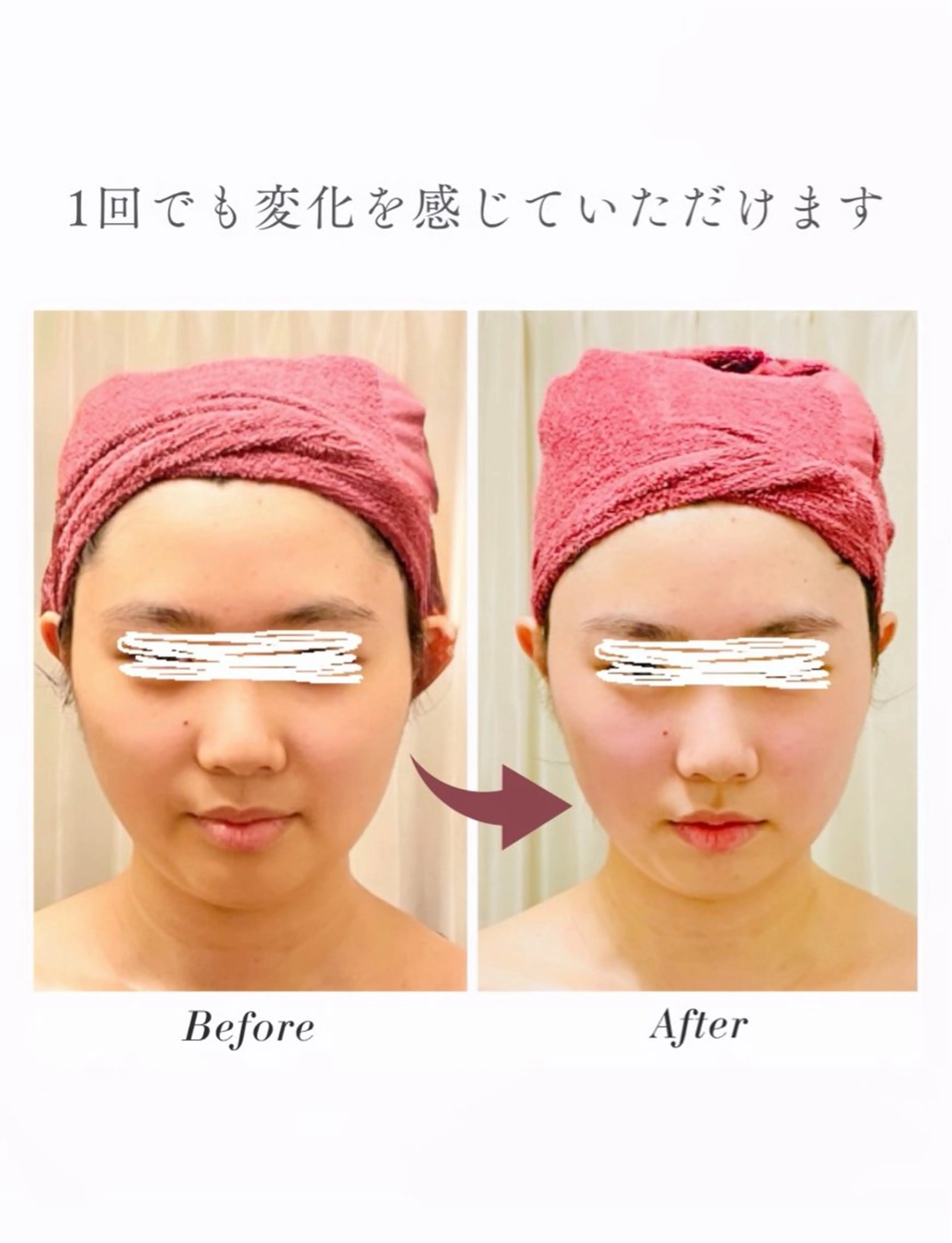 エステ 35歳からの エイジングケアサロンのエステ・リラクイメージ