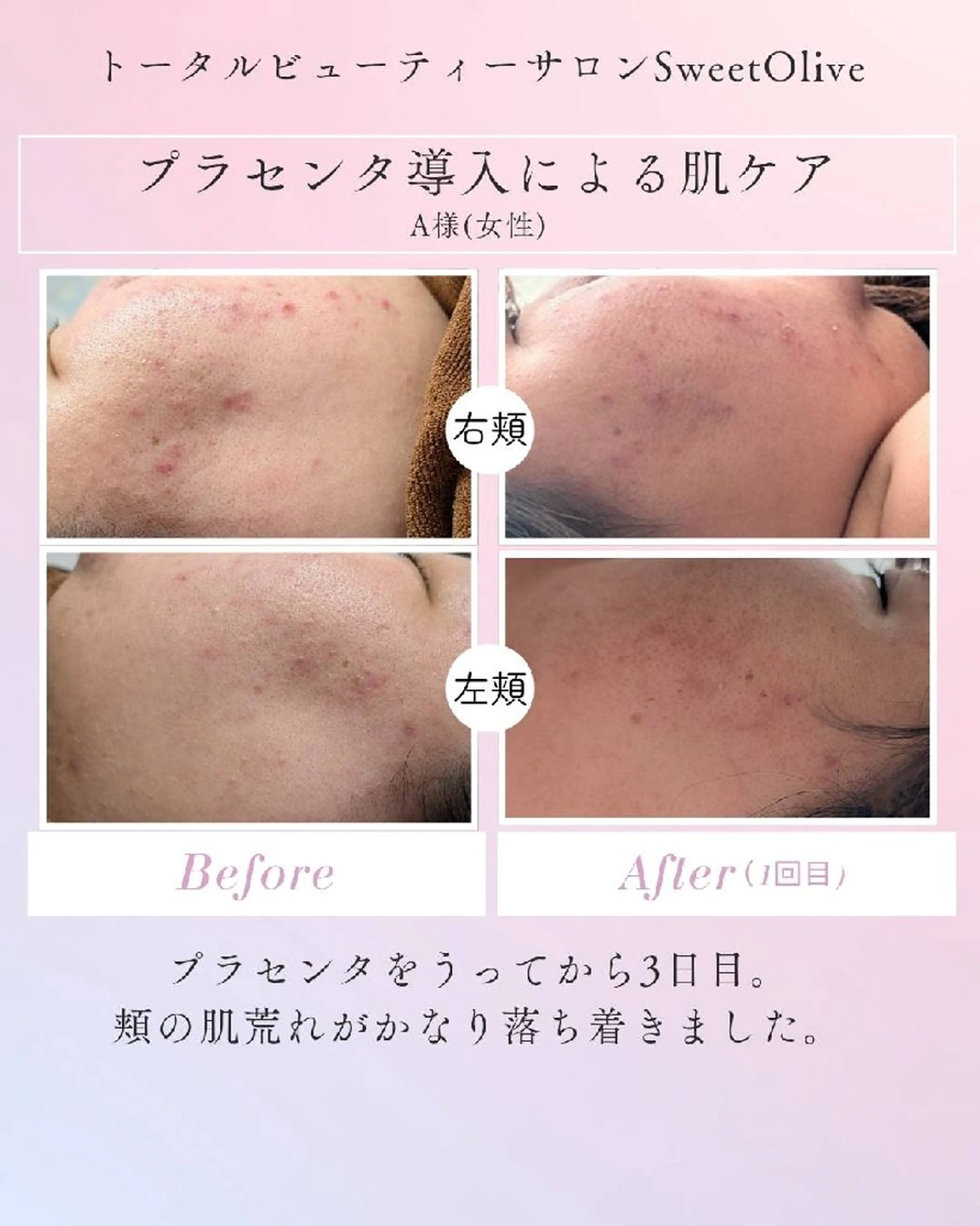 SweetOlive 　 Akaneのエステ・リラクイメージ