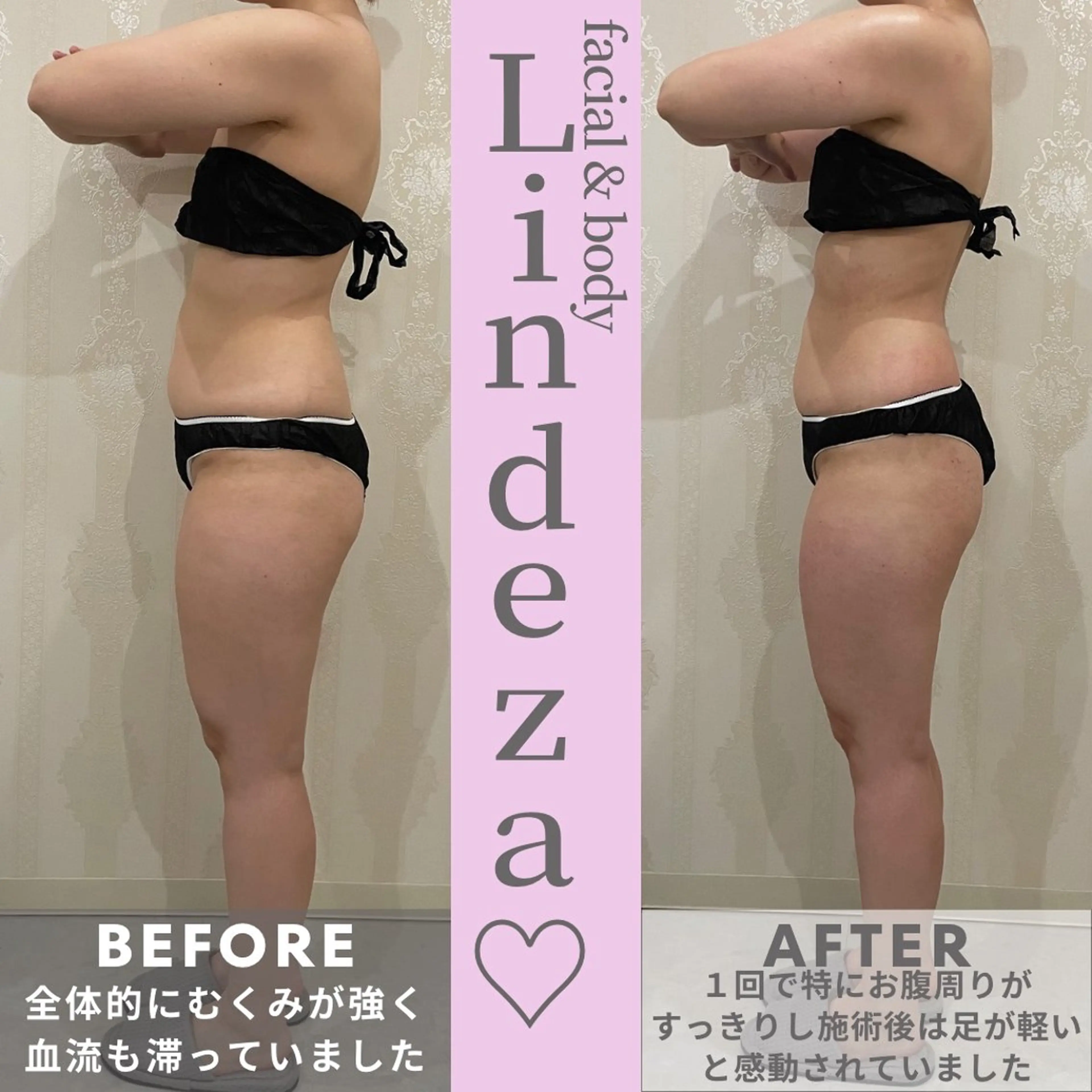 リンデザ 山口のエステ・リラクイメージ