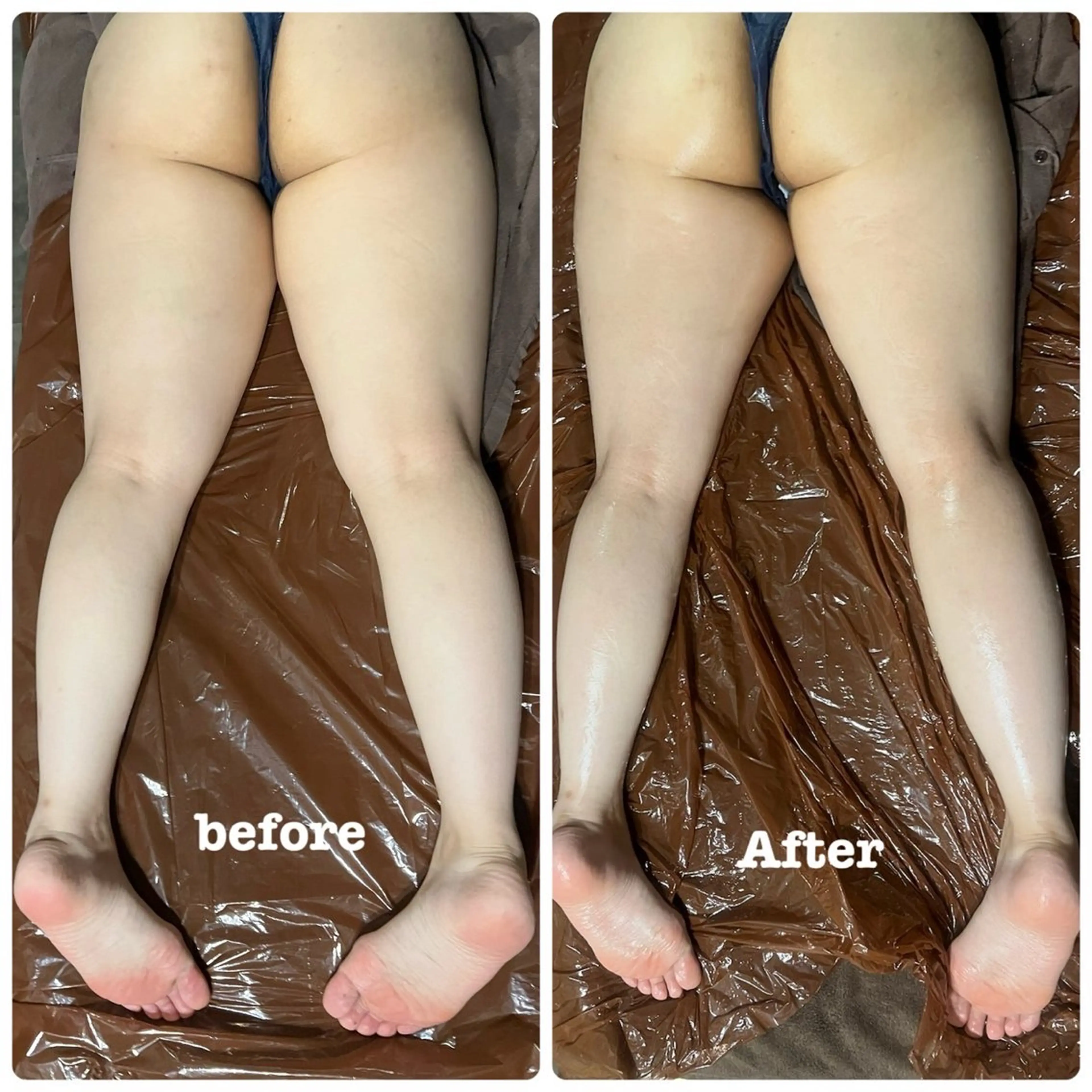 下半身スッキリ😌脚痩せコース👠 キャビテーション&ラジオ波→オールハンドマッサージ⭐️の写真