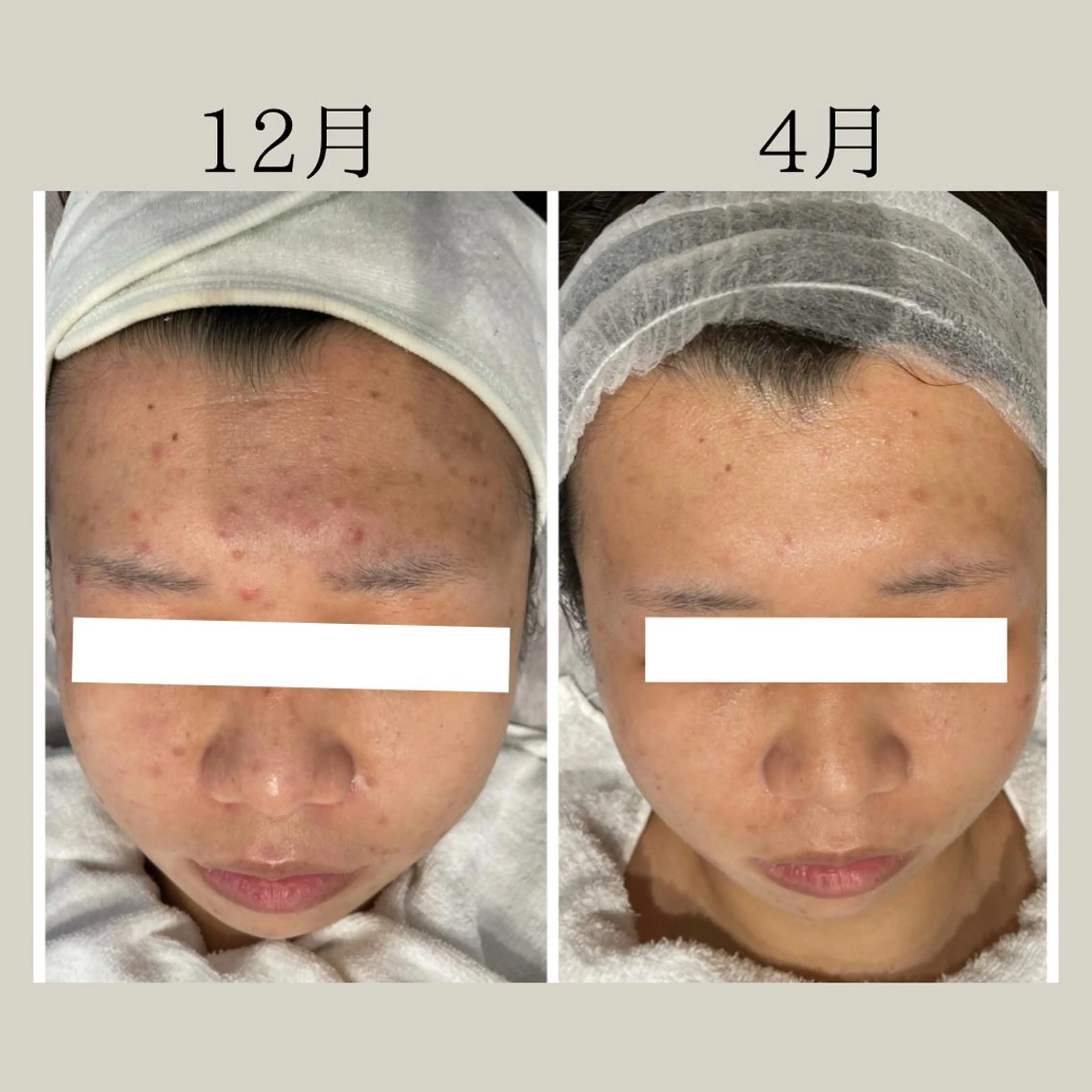 エステ リラク 小林 玲菜のエステ・リラクイメージ