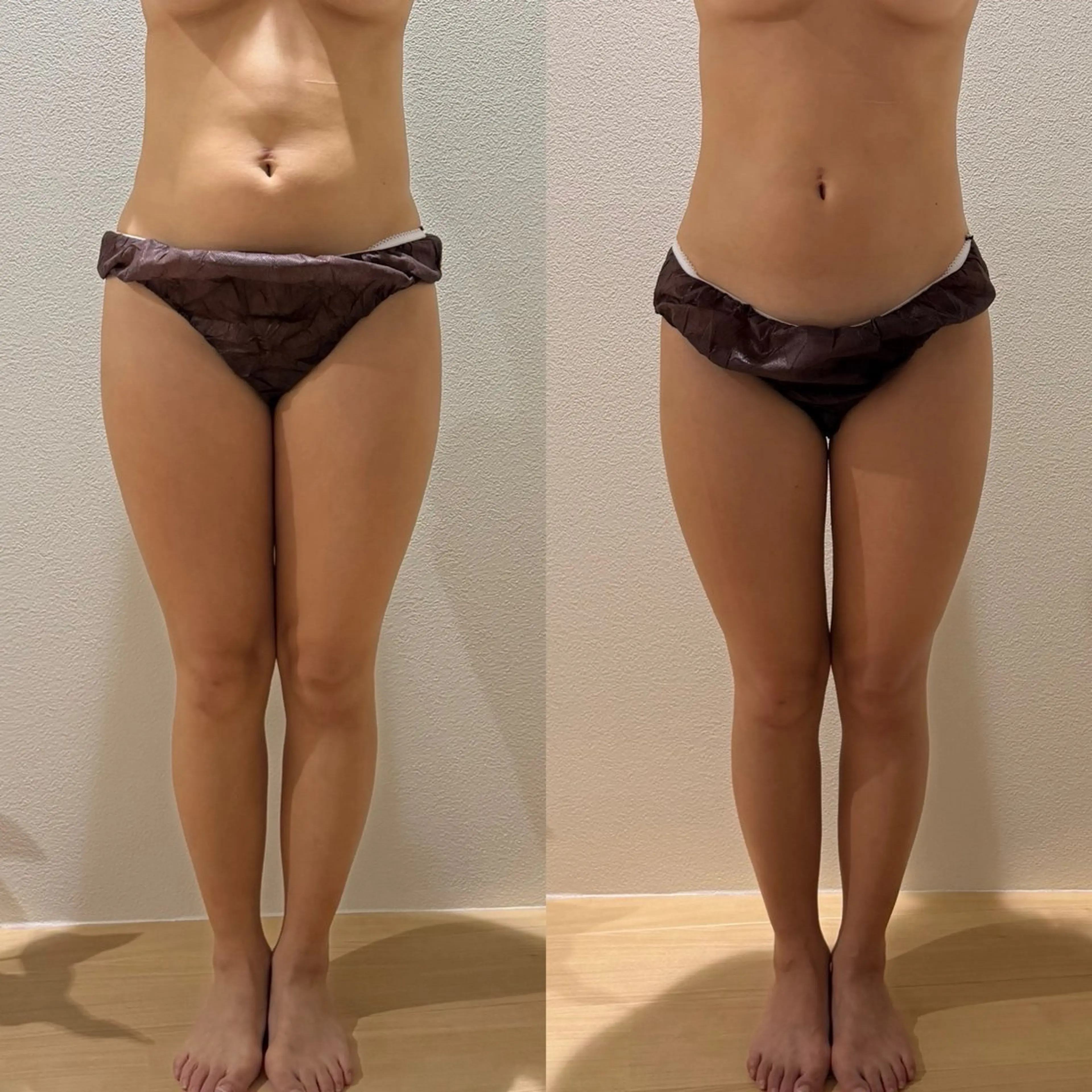 エステ リラク 睡眠の質／体質改善 c.iエステティックのエステ・リラクイメージ