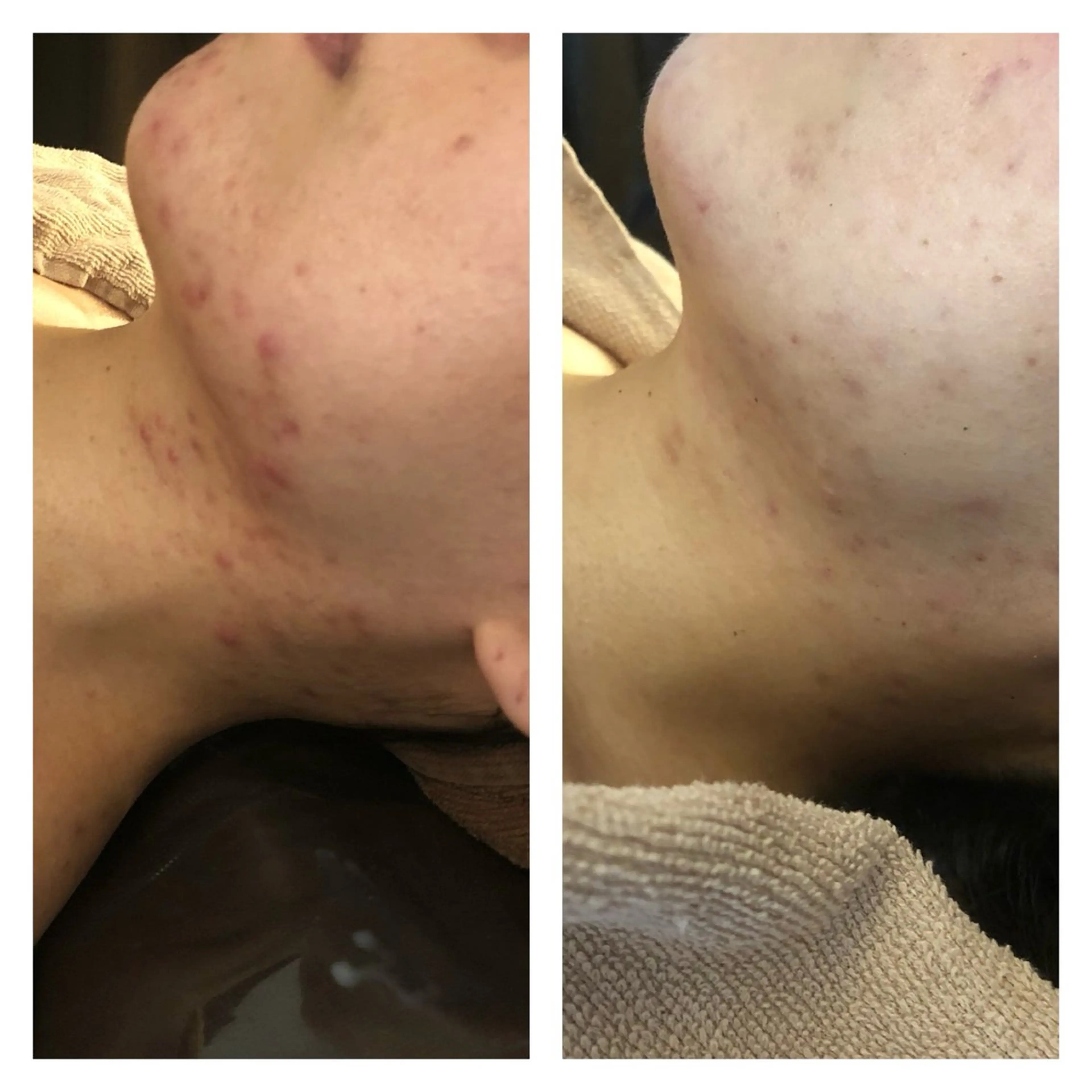 エステ 毛穴ニキビ専門 ビューティーグランツのエステ・リラクイメージ