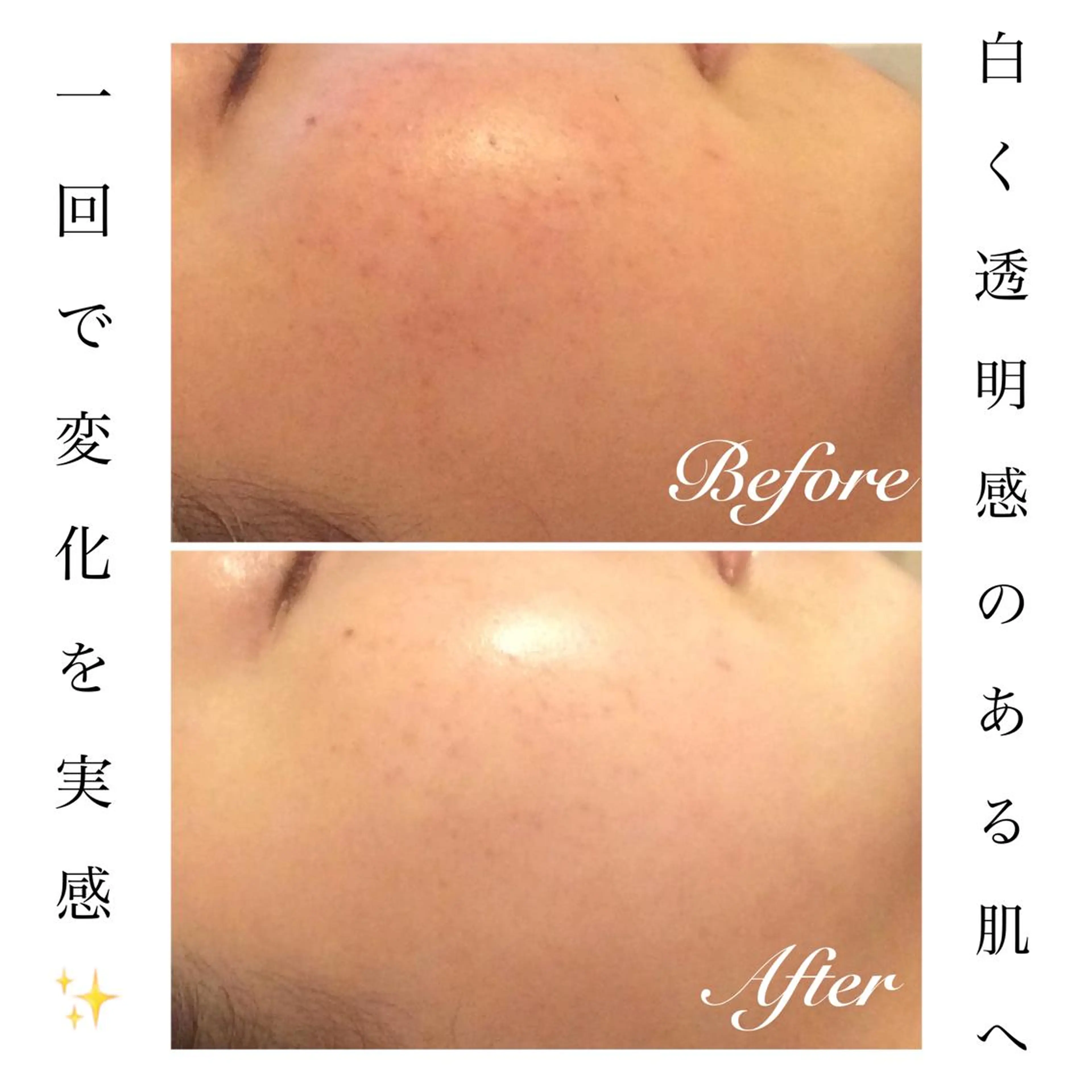 エステ リラク ダイエット・美肌ケア fleurのエステ・リラクイメージ