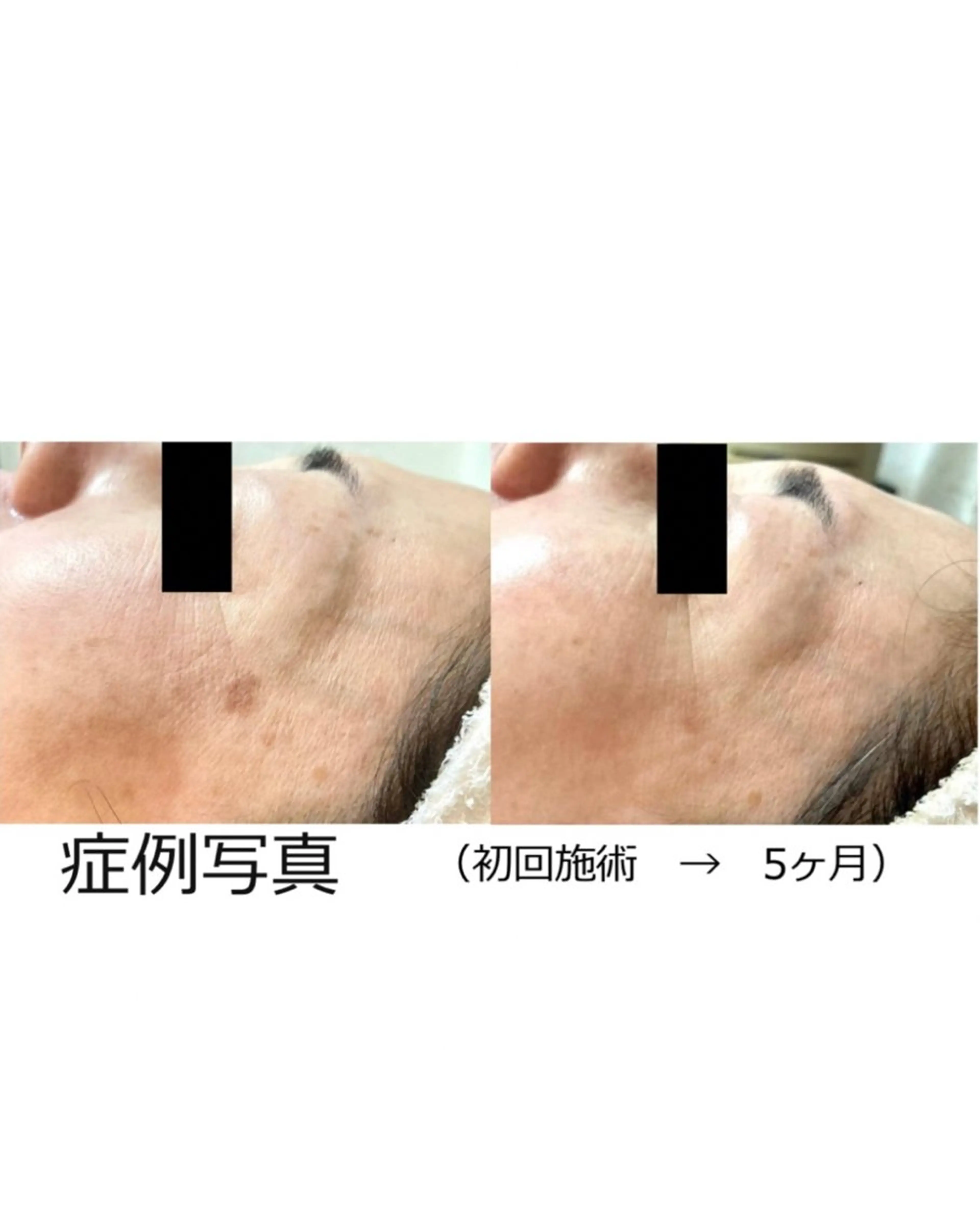 エステ シミ・若返り特化 さゆみのエステ・リラクイメージ