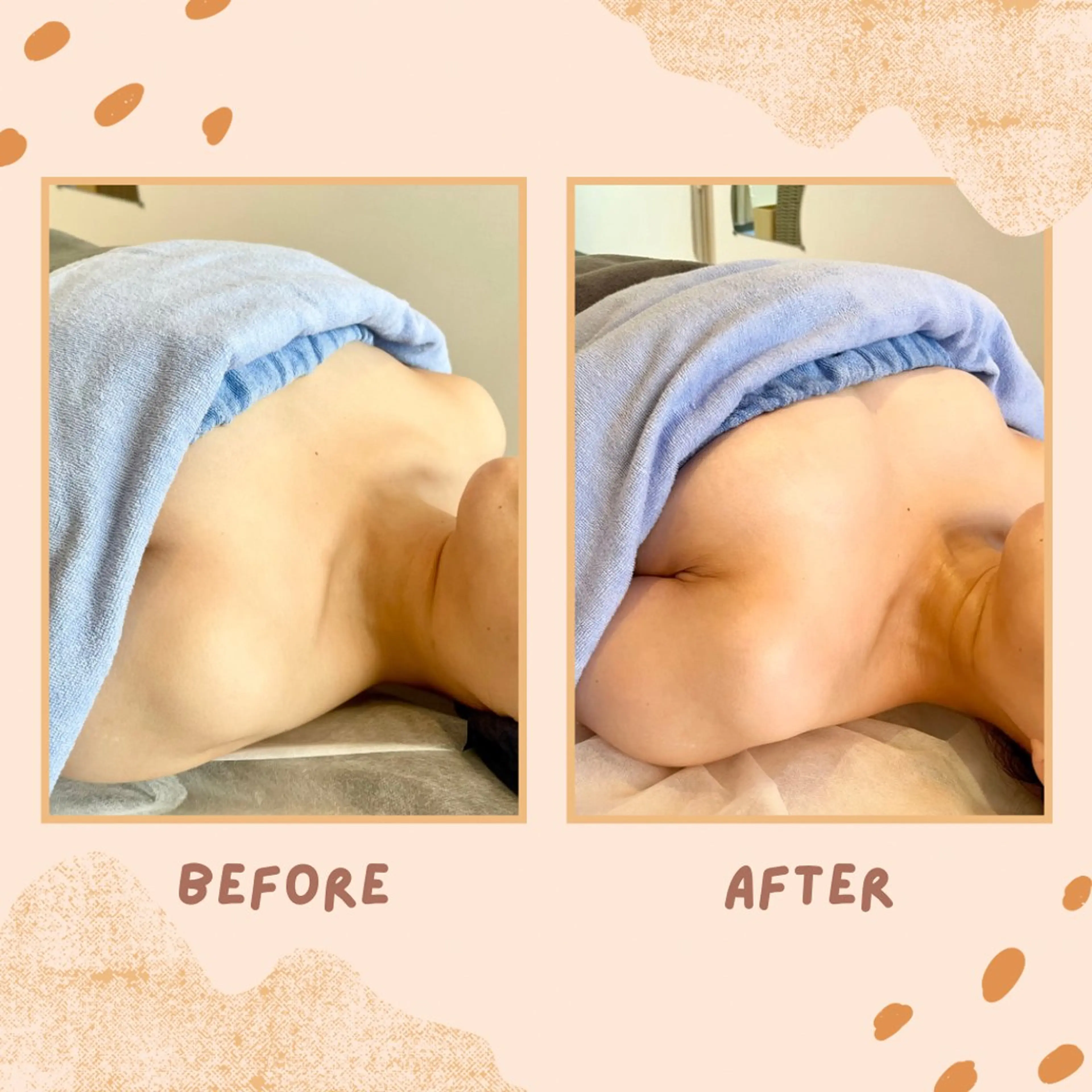 本気でバストアップケア！💓ボンボンバスト💓の写真