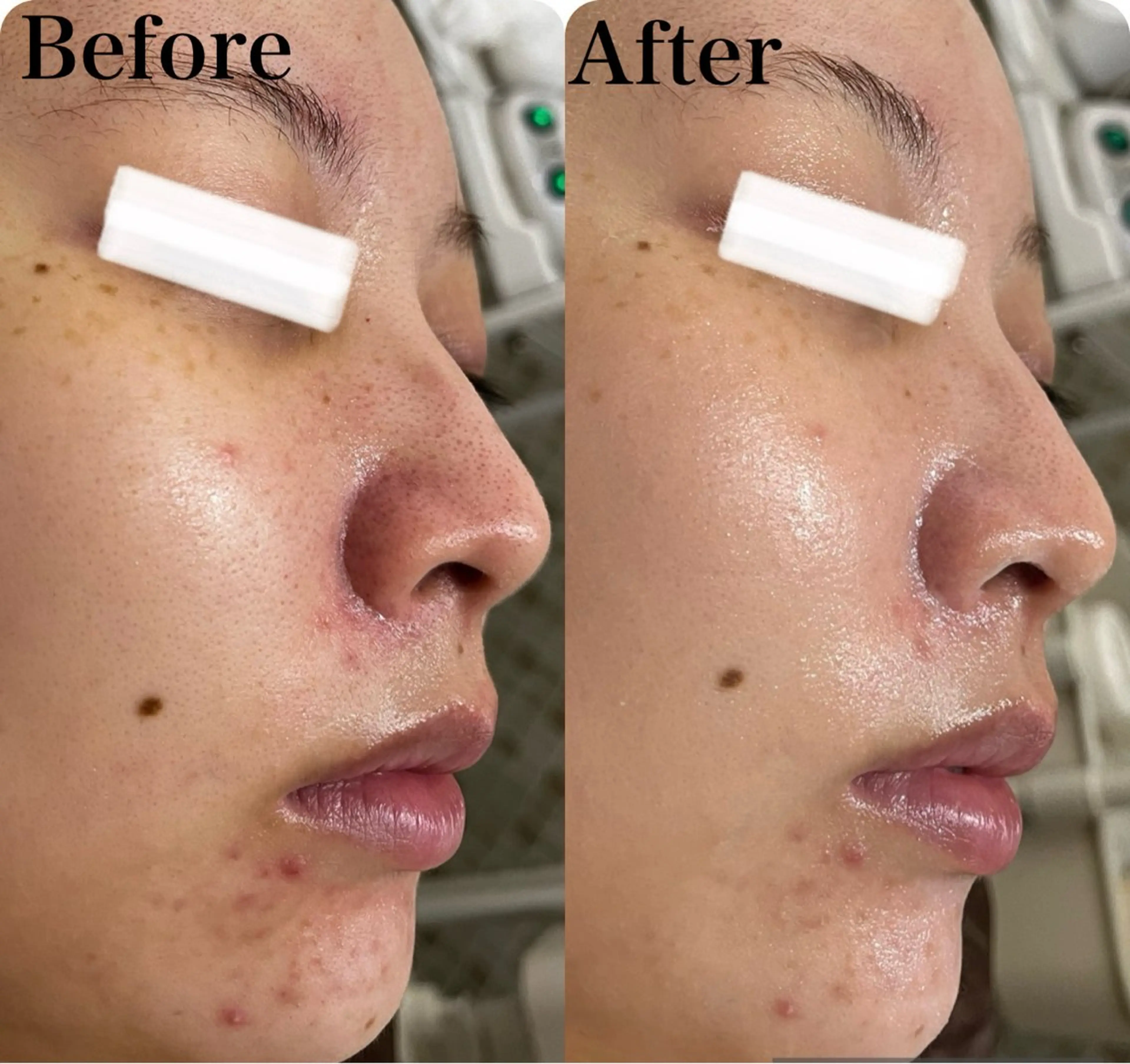 小顔&美肌品川店 Masqueradeのエステ・リラクイメージ