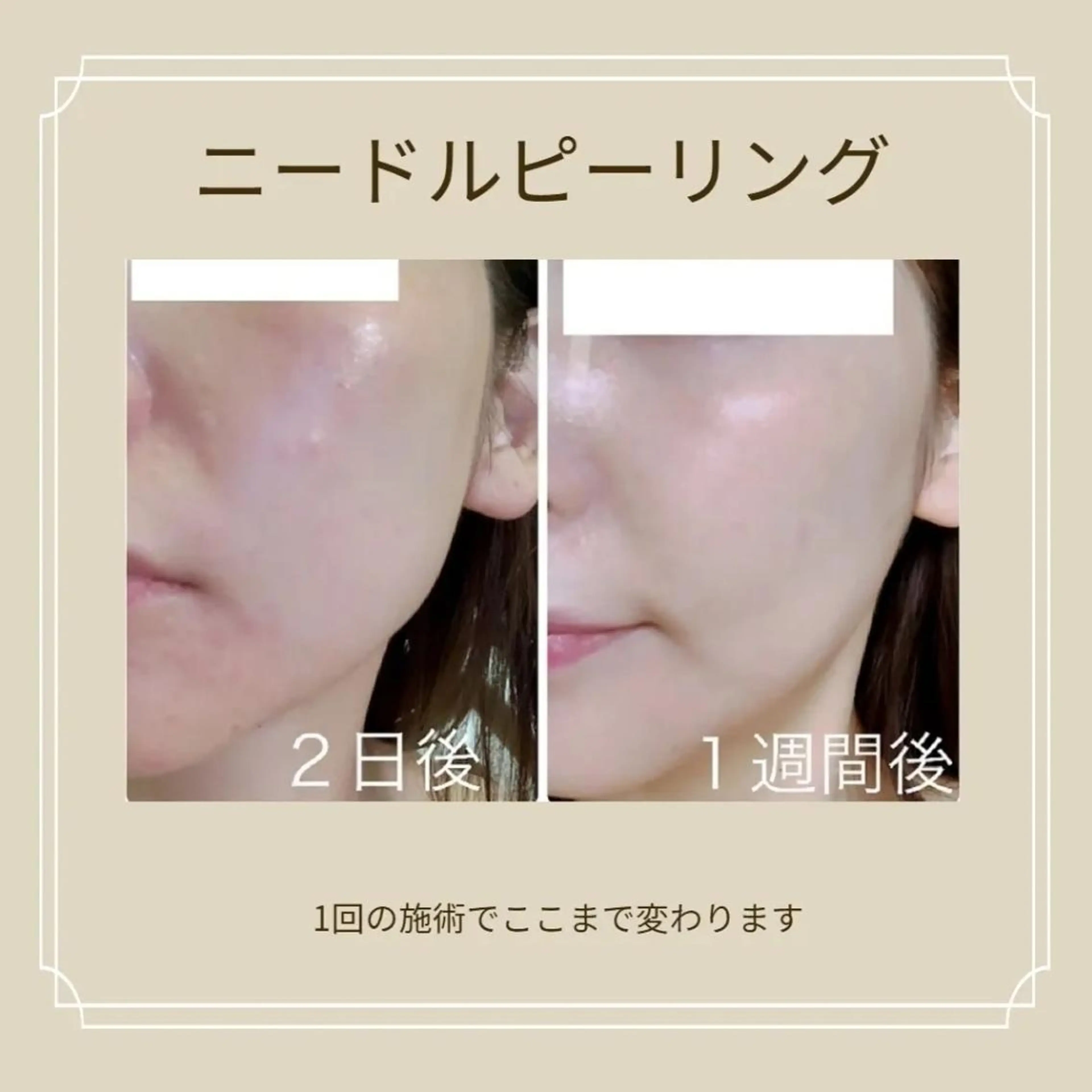 望月 佑弥絵のエステ・リラクイメージ