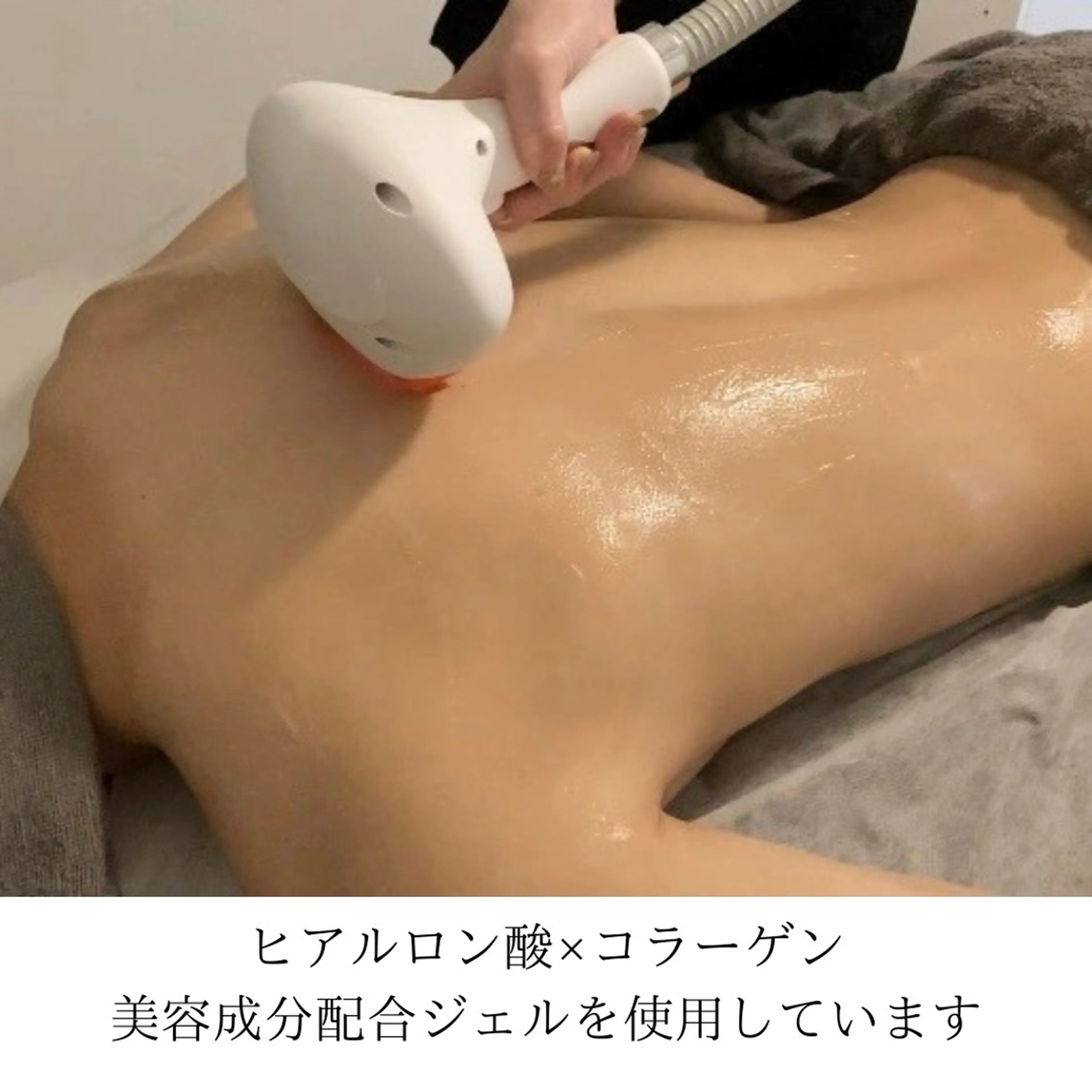 脱毛 An Blossom 脱毛/茅ヶ崎/美咲のエステ・リラクイメージ