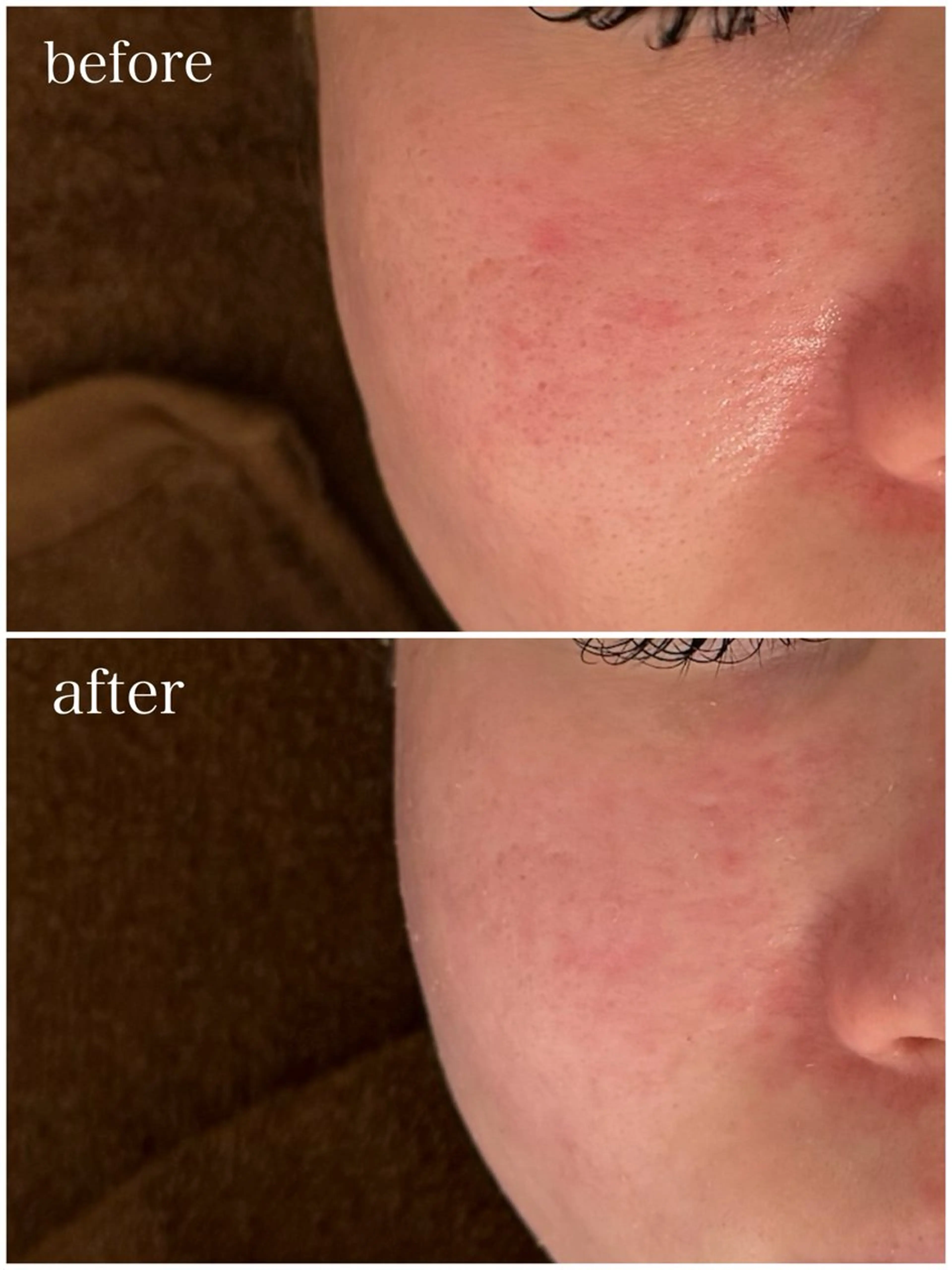 エステ 武藤 那月のエステ・リラクイメージ