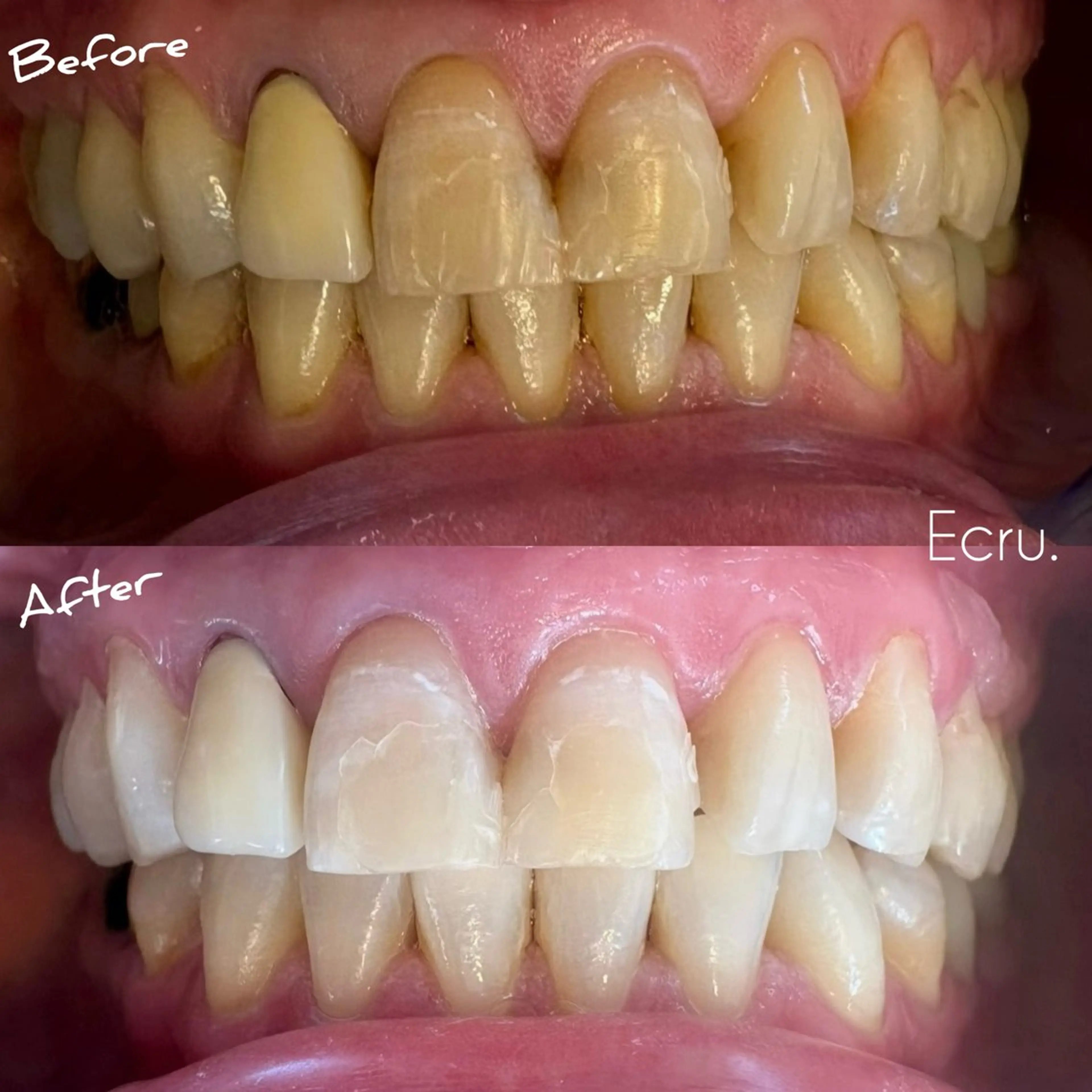 メンズ キッズ ホワイトニングサロン Ecru所属・ホワイトニングサロン Ecru エクリュのその他イメージ