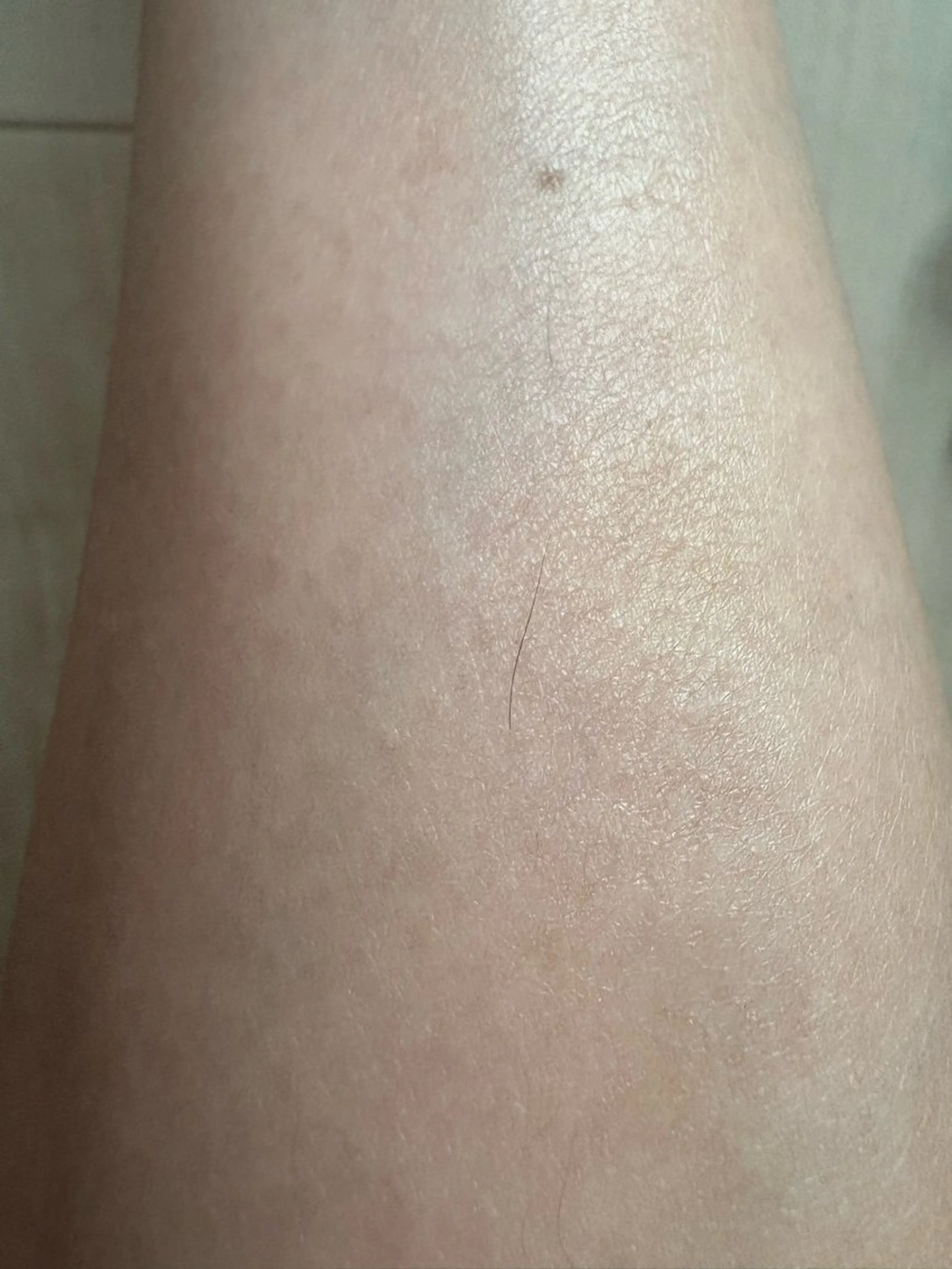 salon NOA所属・脱毛・ﾌｪｲｼｬﾙ 眉毛/山崎のエステ・リラクイメージ