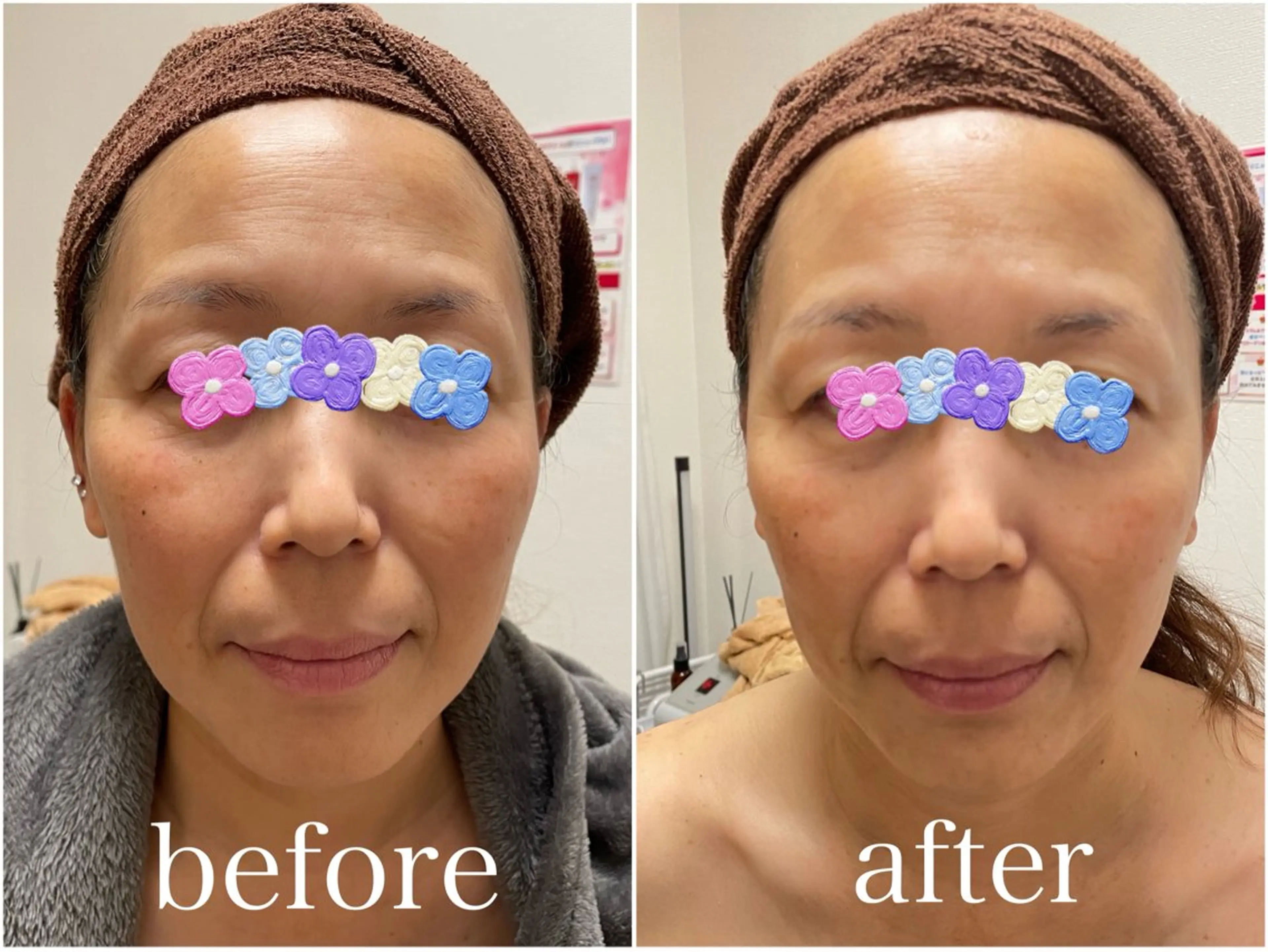 エステ 岸和田／久米田 MooMooのエステ・リラクイメージ