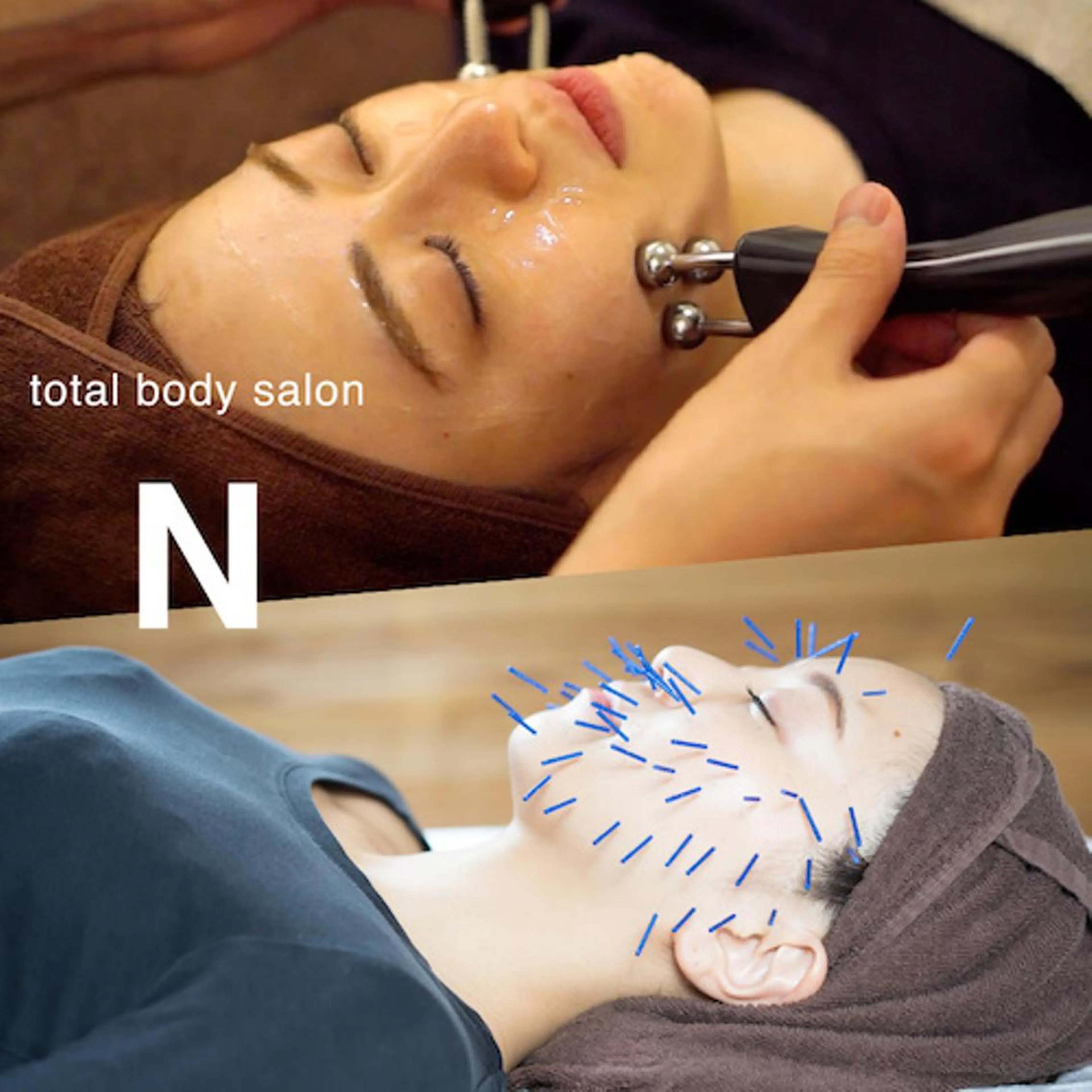 目黒/小顔/骨盤/ 美容鍼/美顔鍼/小林のエステ・リラクイメージ