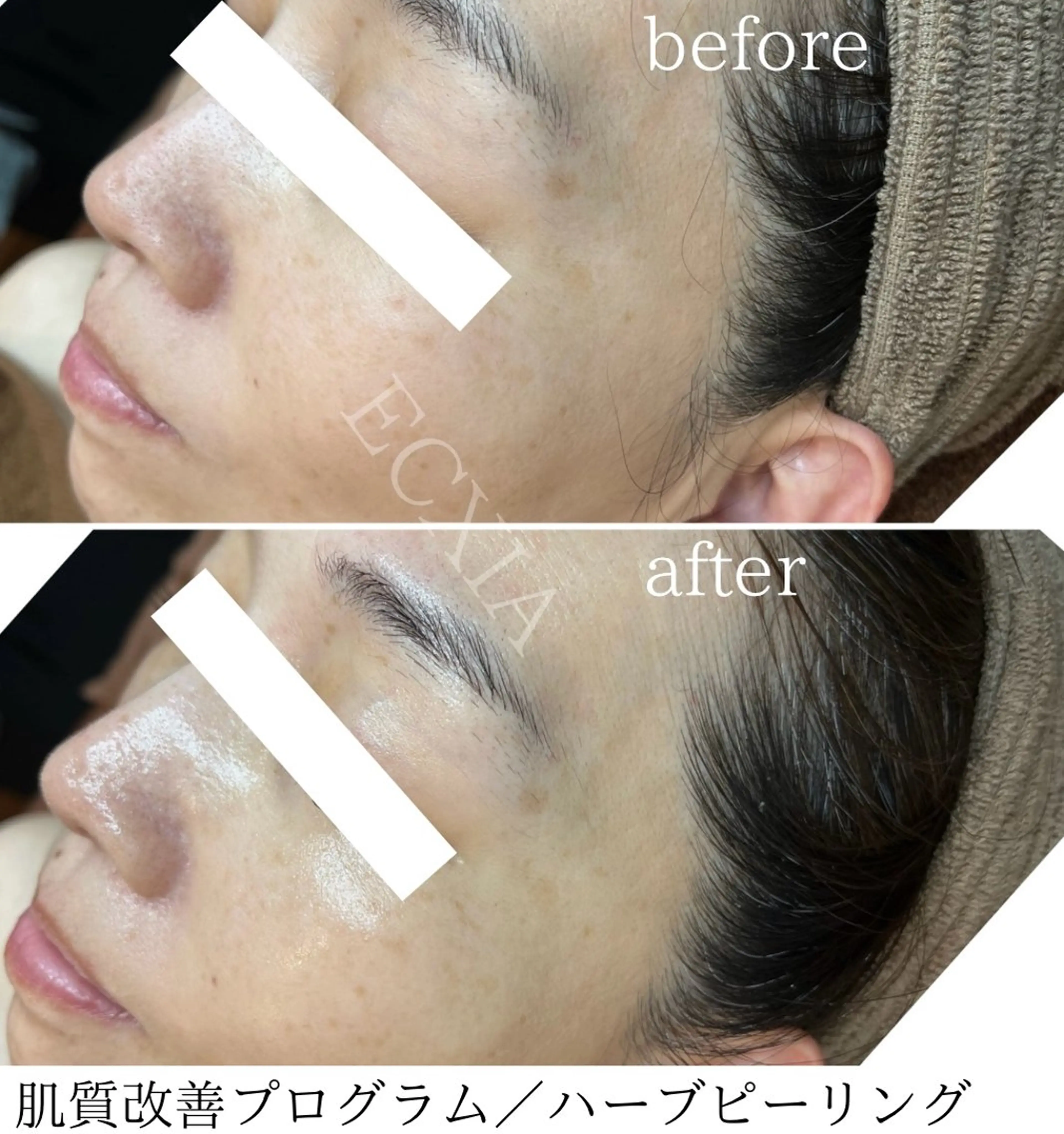 エステ ECXIA 【エクシア】のエステ・リラクイメージ