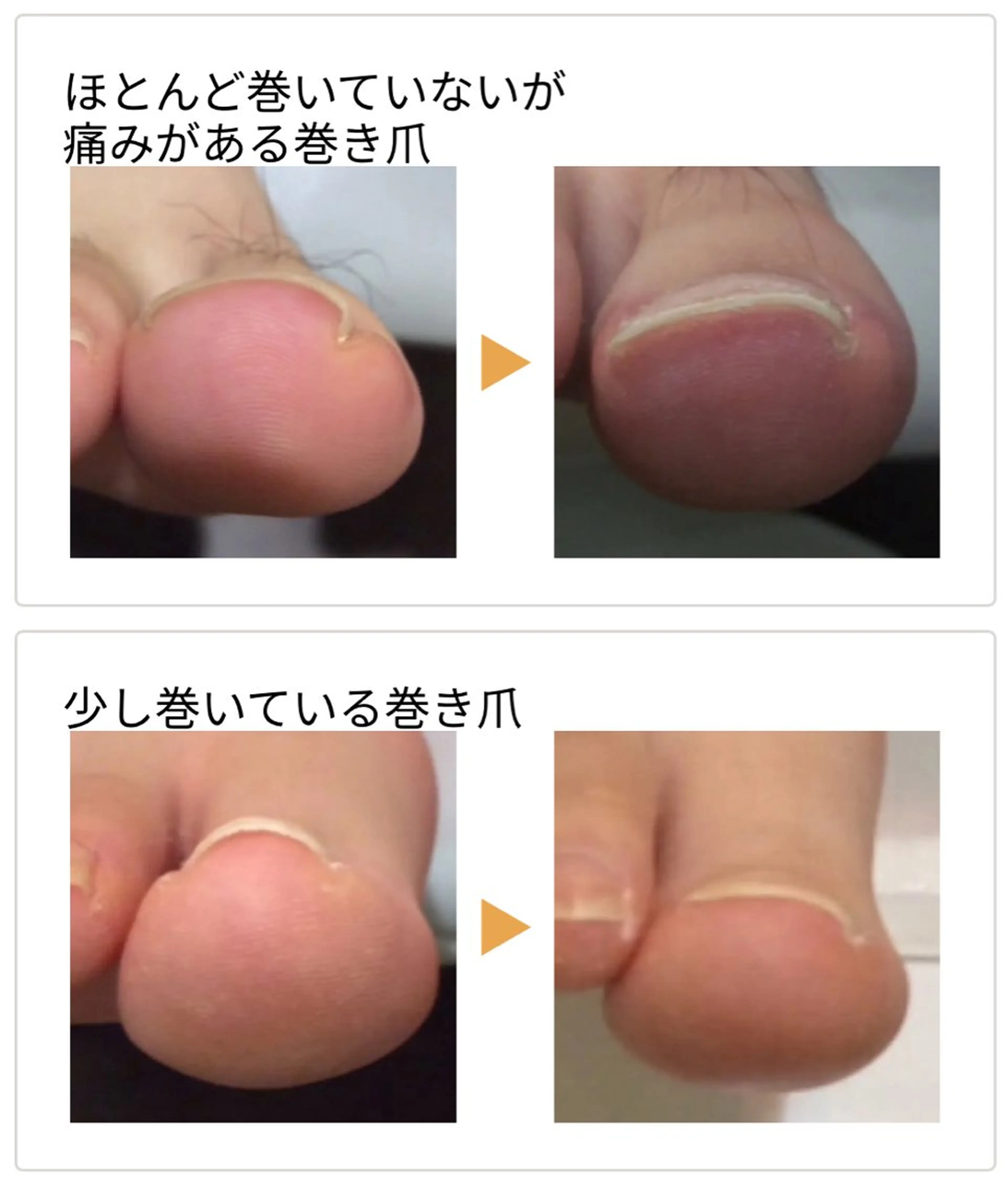 その他 日本巻き爪センター渋谷院所属・日本巻き爪センター 渋谷院のエステ・リラクイメージ