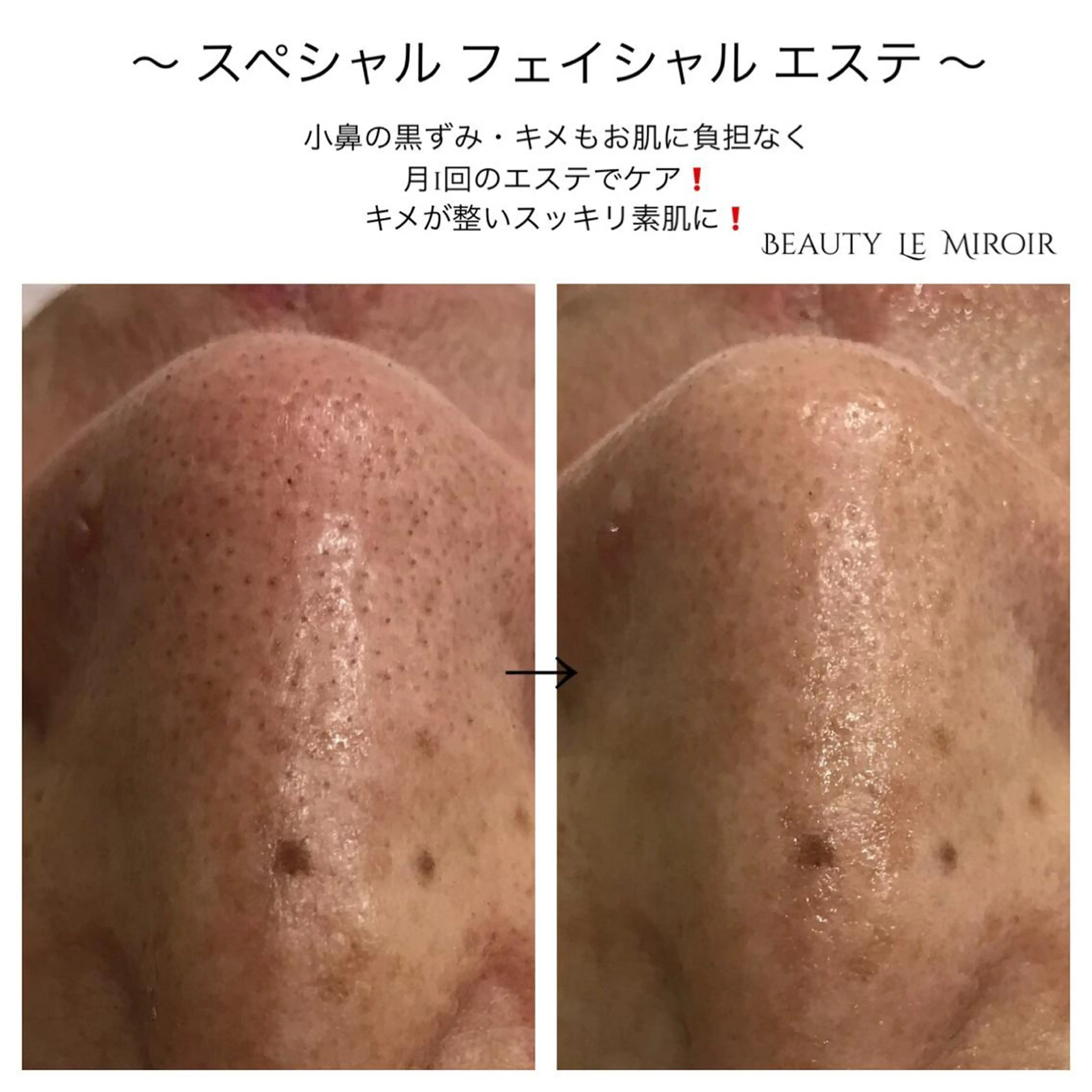 ビューティー ミロワールのエステ・リラクイメージ