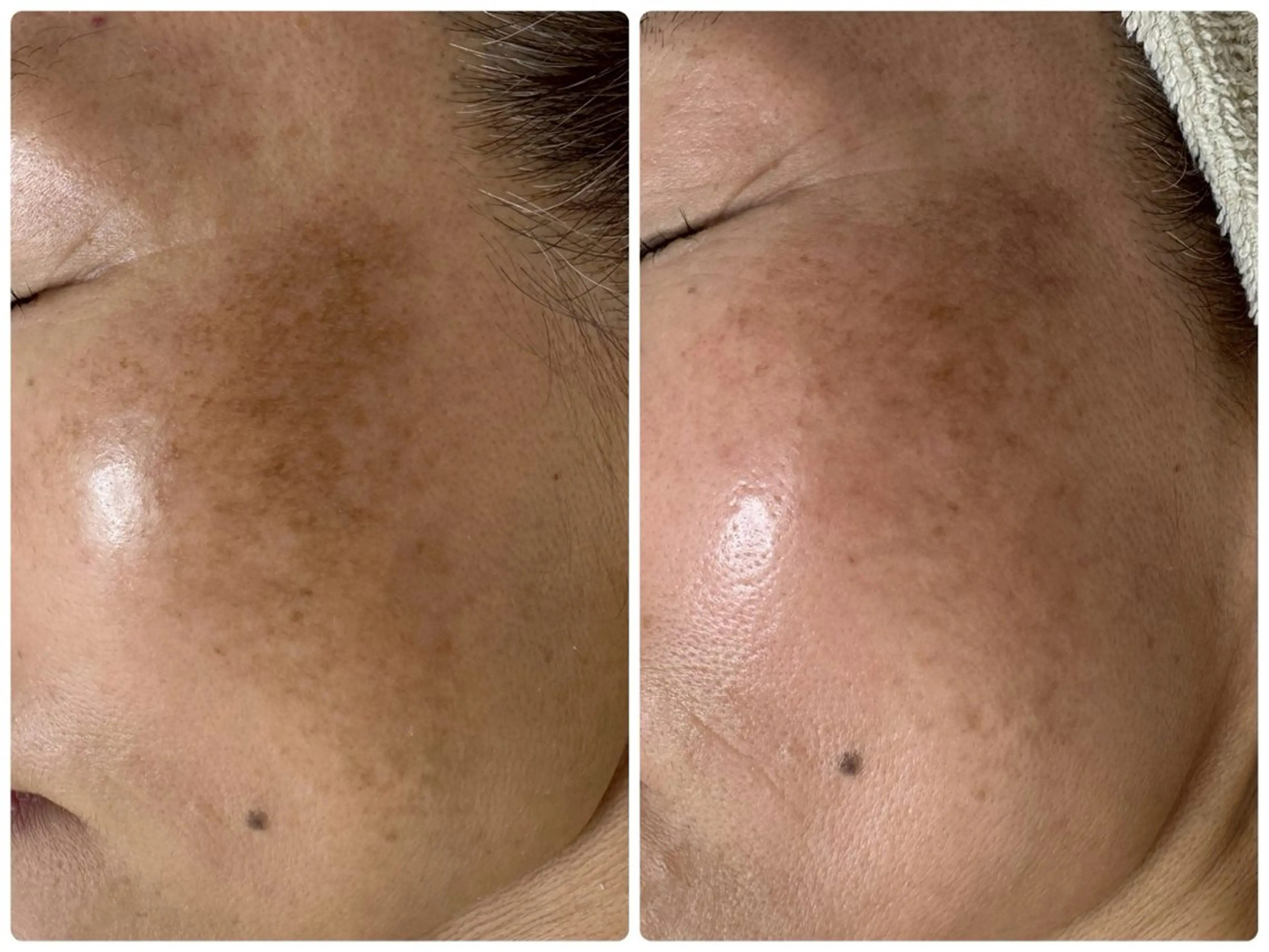 シミ毛穴専門店 yucca(ユッカ)のエステ・リラクイメージ