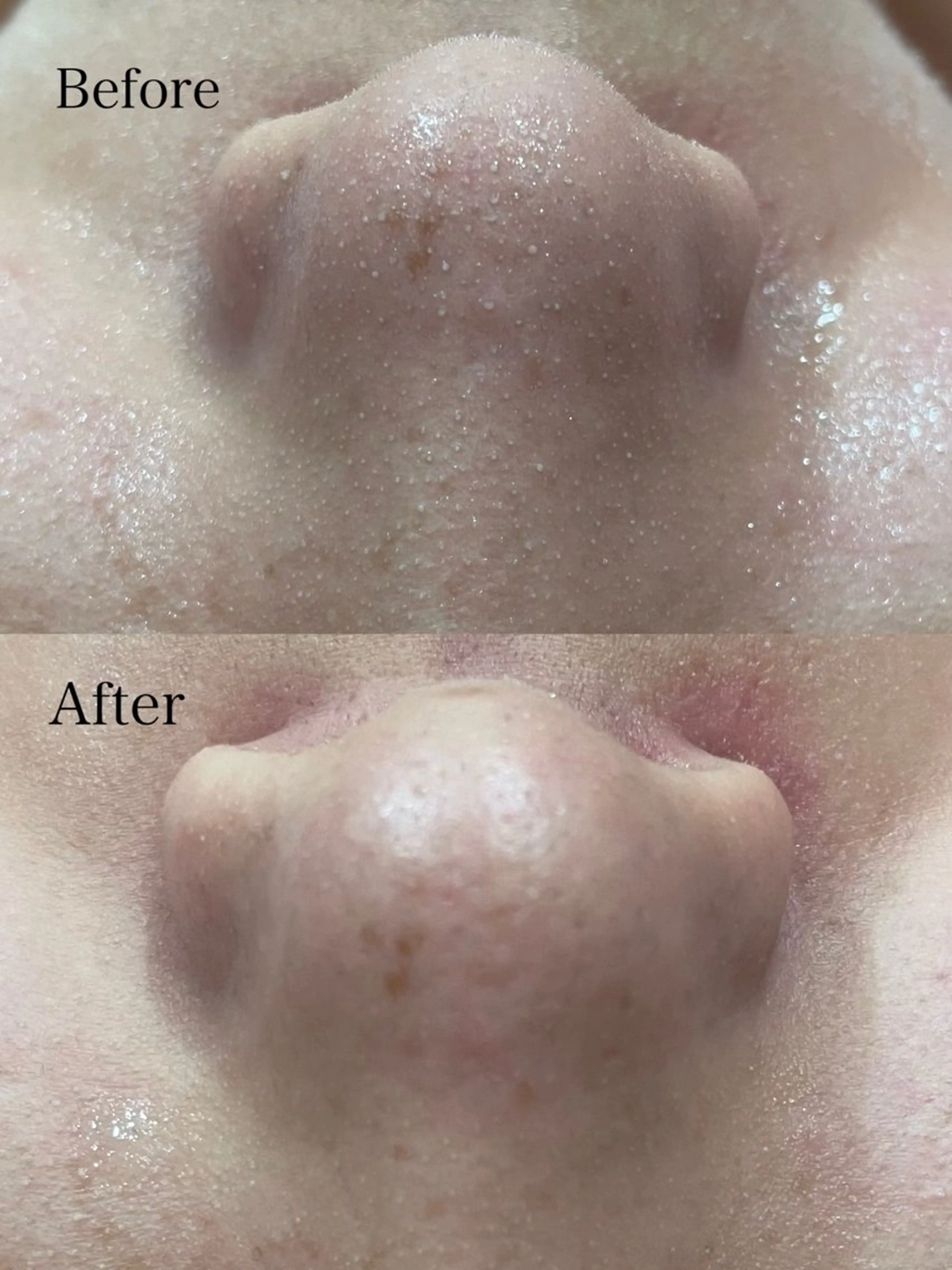 エステ 肌質改善専門サロン Bellmi/心斎橋のエステ・リラクイメージ